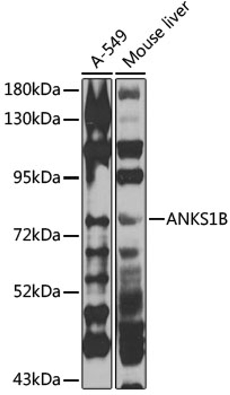 Western blot analysis of extracts of various cell lines, using ANKS1B antibody (23-207) at 1:1000 dilution.<br/>Secondary antibody: HRP Goat Anti-Rabbit IgG (H+L) at 1:10000 dilution.<br/>Lysates/proteins: 25ug per lane.<br/>Blocking buffer: 3% nonfat dry milk in TBST.<br/>Detection: ECL Enhanced Kit.<br/>Exposure time: 90s.