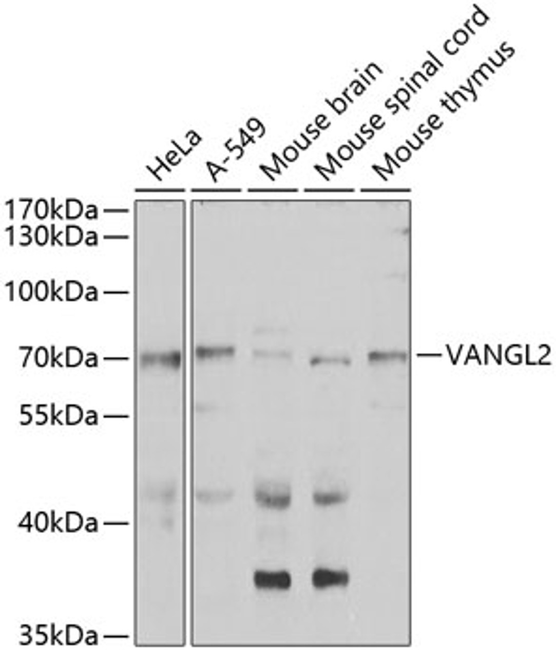 Western blot analysis of extracts of various cell lines, using VANGL2 antibody (23-210) at 1:1000 dilution.<br/>Secondary antibody: HRP Goat Anti-Rabbit IgG (H+L) at 1:10000 dilution.<br/>Lysates/proteins: 25ug per lane.<br/>Blocking buffer: 3% nonfat dry milk in TBST.<br/>Detection: ECL Basic Kit.<br/>Exposure time: 90s.