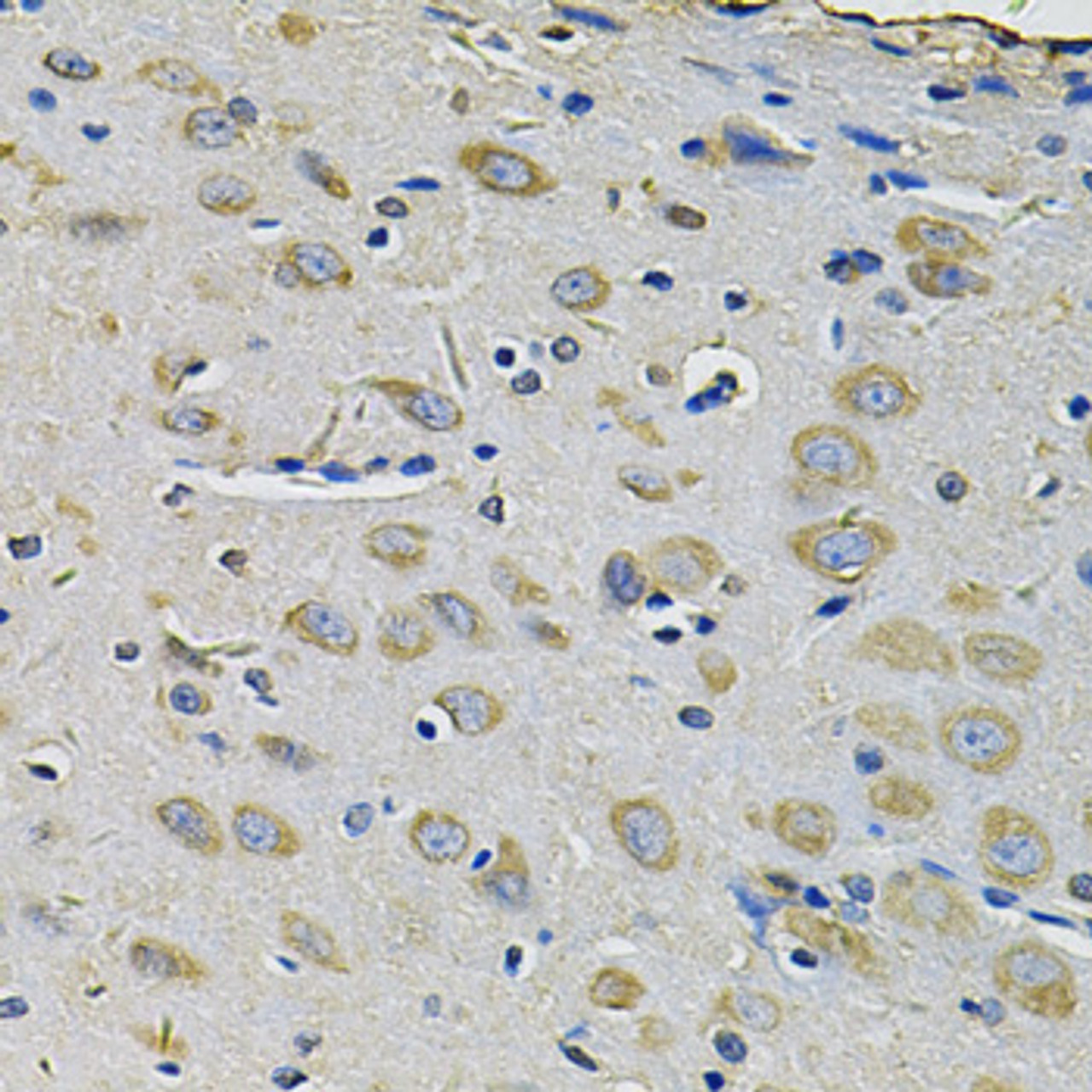 Immunohistochemistry of paraffin-embedded rat brain using RAB17 Antibody (23-213) at dilution of 1:100 (40x lens) .
