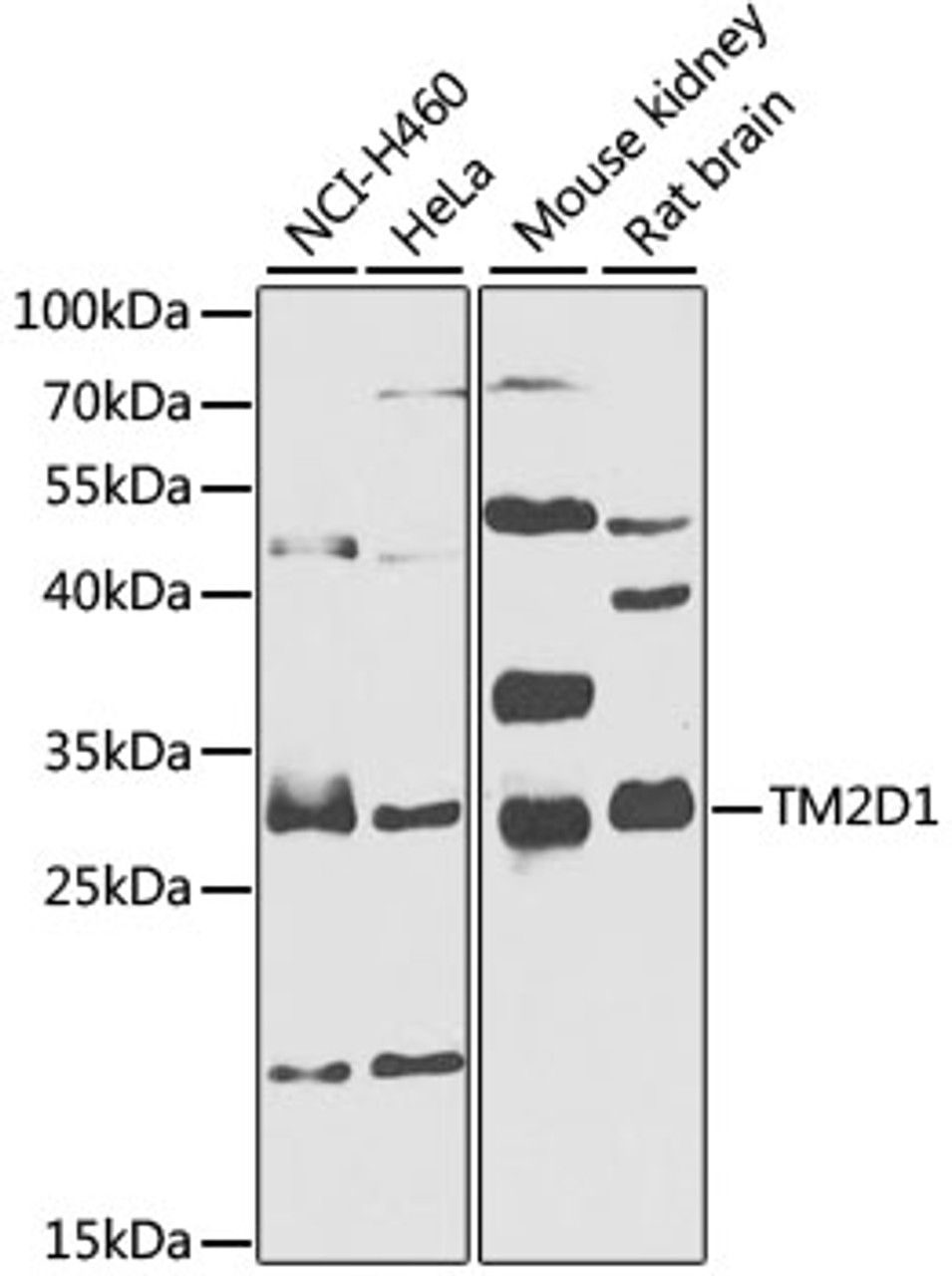 Western blot analysis of extracts of various cell lines, using TM2D1 antibody (23-219) at 1:1000 dilution.<br/>Secondary antibody: HRP Goat Anti-Rabbit IgG (H+L) at 1:10000 dilution.<br/>Lysates/proteins: 25ug per lane.<br/>Blocking buffer: 3% nonfat dry milk in TBST.<br/>Detection: ECL Basic Kit.<br/>Exposure time: 90s.