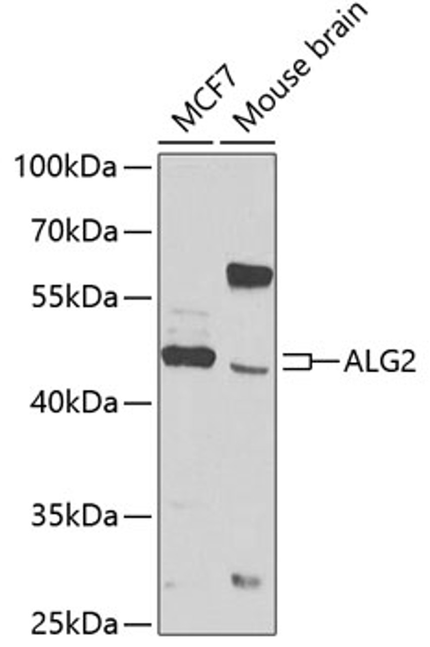 Western blot analysis of extracts of various cell lines, using ALG2 antibody (23-221) at 1:1000 dilution._Secondary antibody: HRP Goat Anti-Rabbit IgG (H+L) at 1:10000 dilution._Lysates/proteins: 25ug per lane._Blocking buffer: 3% nonfat dry milk in TBST._Detection: ECL Basic Kit._Exposure time: 90s.