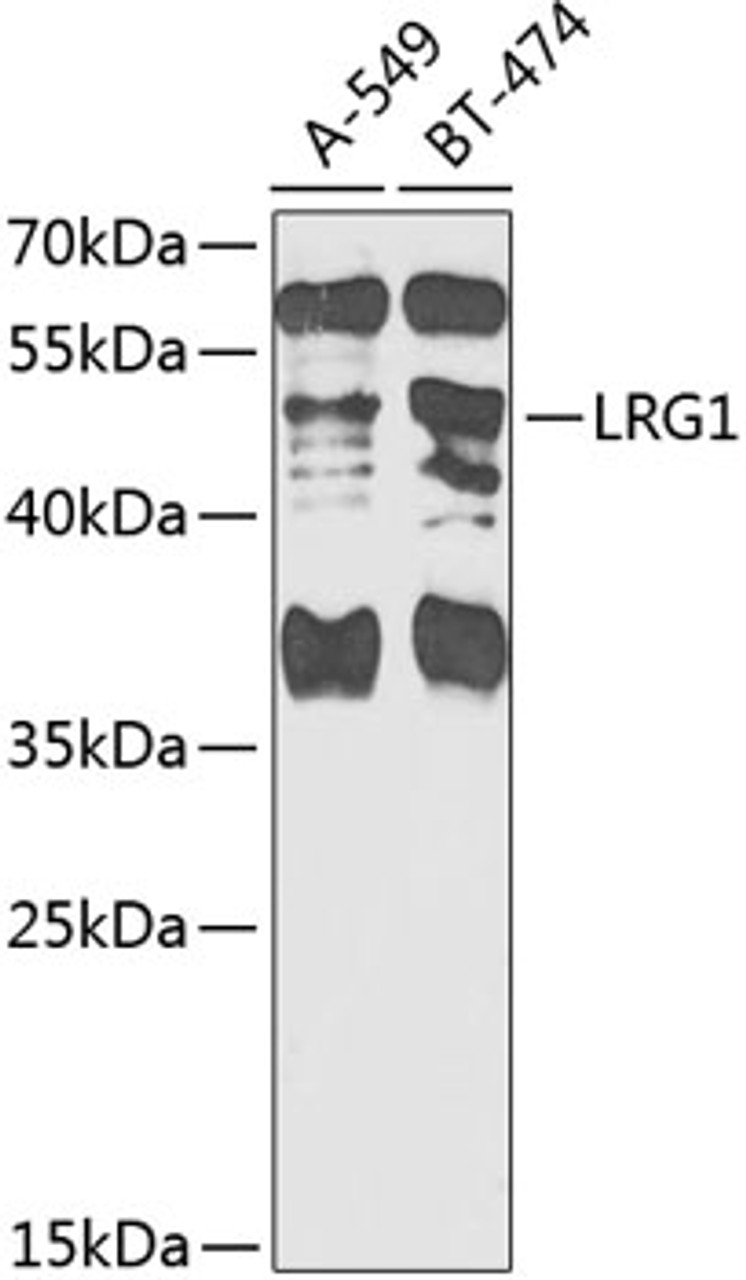 Western blot analysis of extracts of various cell lines, using LRG1 antibody (23-228) at 1:1000 dilution.<br/>Secondary antibody: HRP Goat Anti-Rabbit IgG (H+L) at 1:10000 dilution.<br/>Lysates/proteins: 25ug per lane.<br/>Blocking buffer: 3% nonfat dry milk in TBST.<br/>Detection: ECL Basic Kit.<br/>Exposure time: 90s.