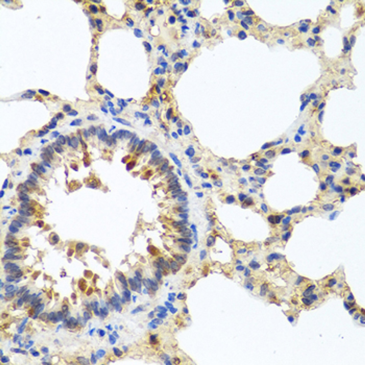 Immunohistochemistry of paraffin-embedded rat lung using LRG1 antibody (23-228) at dilution of 1:100 (40x lens) .