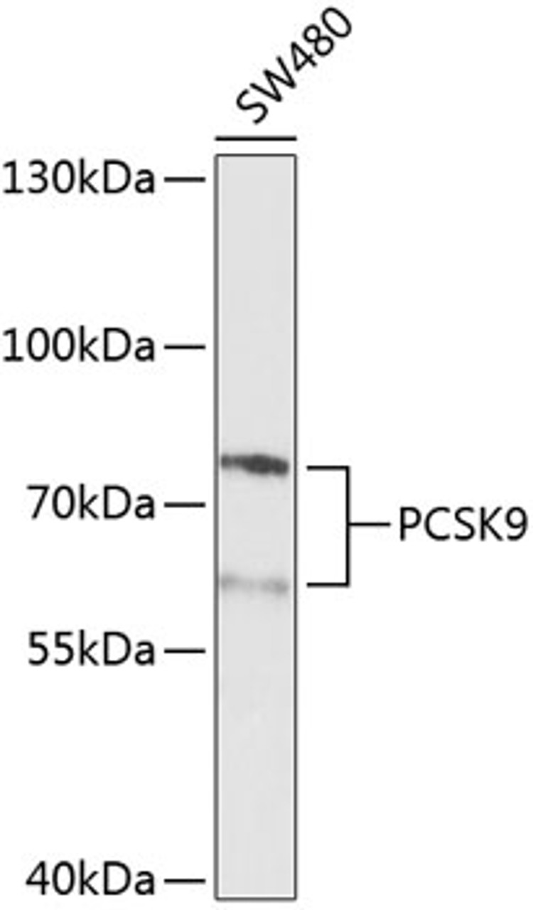 Western blot analysis of extracts of SW480 cells, using PCSK9 Antibody (23-233) at 1:1000 dilution.<br/>Secondary antibody: HRP Goat Anti-Rabbit IgG (H+L) at 1:10000 dilution.<br/>Lysates/proteins: 25ug per lane.<br/>Blocking buffer: 3% nonfat dry milk in TBST.<br/>Detection: ECL Basic Kit.<br/>Exposure time: 30s.