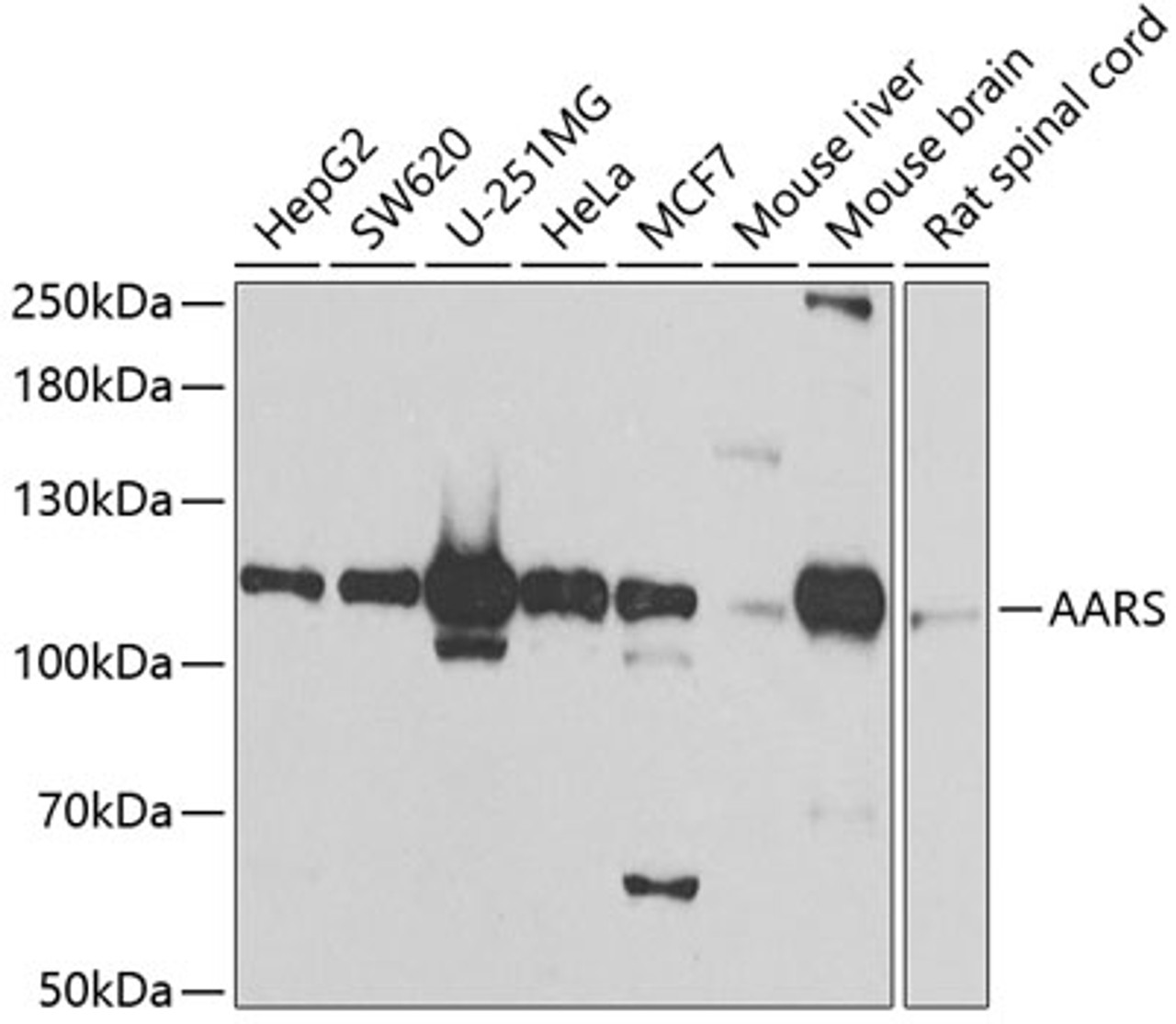 Western blot analysis of extracts of various cell lines, using AARS antibody (23-235) at 1:1000 dilution.<br/>Secondary antibody: HRP Goat Anti-Rabbit IgG (H+L) at 1:10000 dilution.<br/>Lysates/proteins: 25ug per lane.<br/>Blocking buffer: 3% nonfat dry milk in TBST.<br/>Detection: ECL Basic Kit.<br/>Exposure time: 90s.