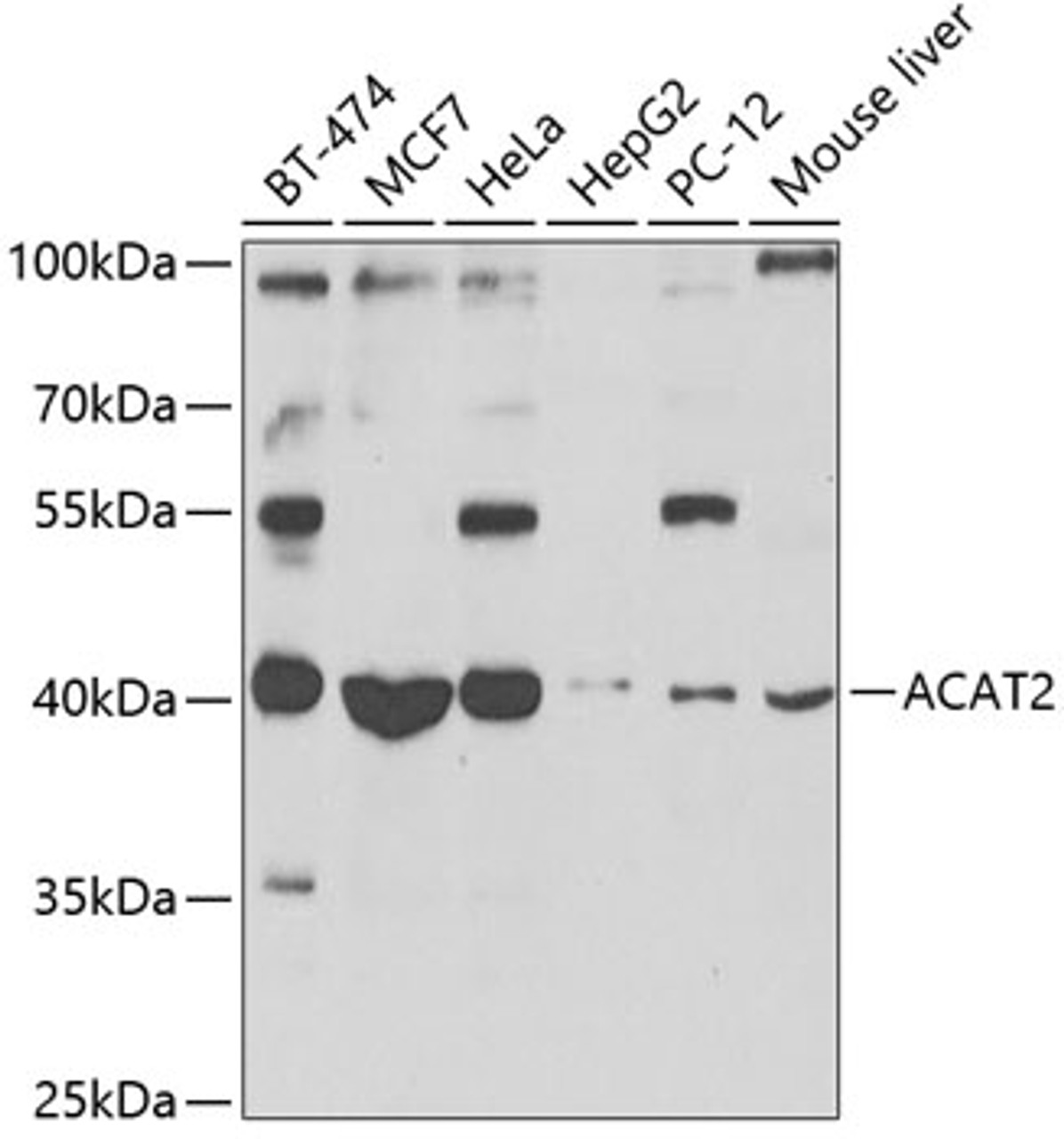 Western blot analysis of extracts of various cell lines, using ACAT2 antibody (23-237) at 1:1000 dilution.<br/>Secondary antibody: HRP Goat Anti-Rabbit IgG (H+L) at 1:10000 dilution.<br/>Lysates/proteins: 25ug per lane.<br/>Blocking buffer: 3% nonfat dry milk in TBST.<br/>Detection: ECL Basic Kit.<br/>Exposure time: 90s.