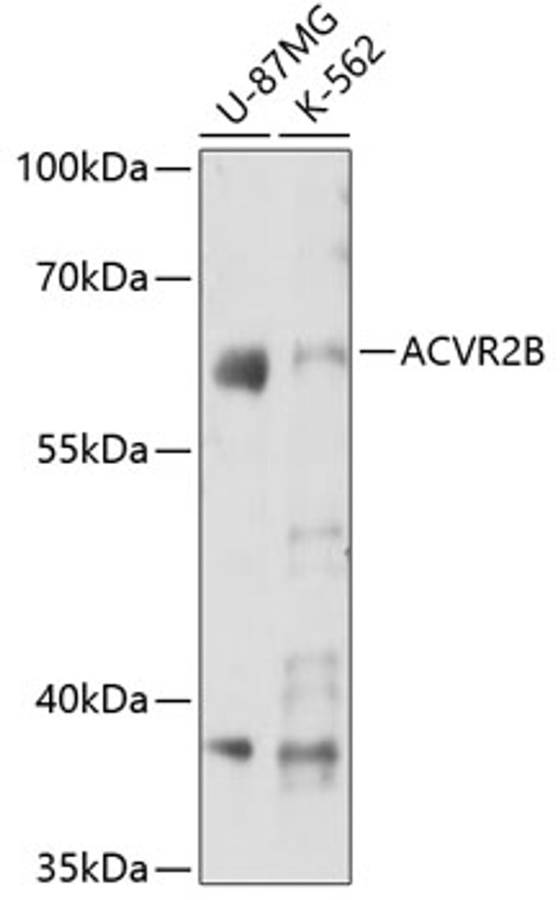 Western blot analysis of extracts of various cell lines, using ACVR2B antibody (23-239) at 1:3000 dilution.<br/>Secondary antibody: HRP Goat Anti-Rabbit IgG (H+L) at 1:10000 dilution.<br/>Lysates/proteins: 25ug per lane.<br/>Blocking buffer: 3% nonfat dry milk in TBST.<br/>Detection: ECL Basic Kit.<br/>Exposure time: 30s.