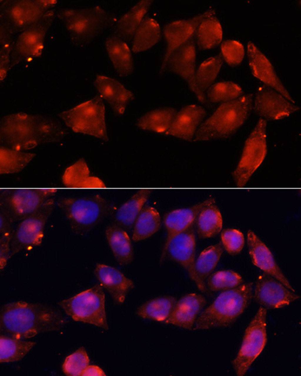 Immunofluorescence analysis of HeLa cells using ACVR2B antibody (23-239) at dilution of 1:100 (40x lens) . Blue: DAPI for nuclear staining.
