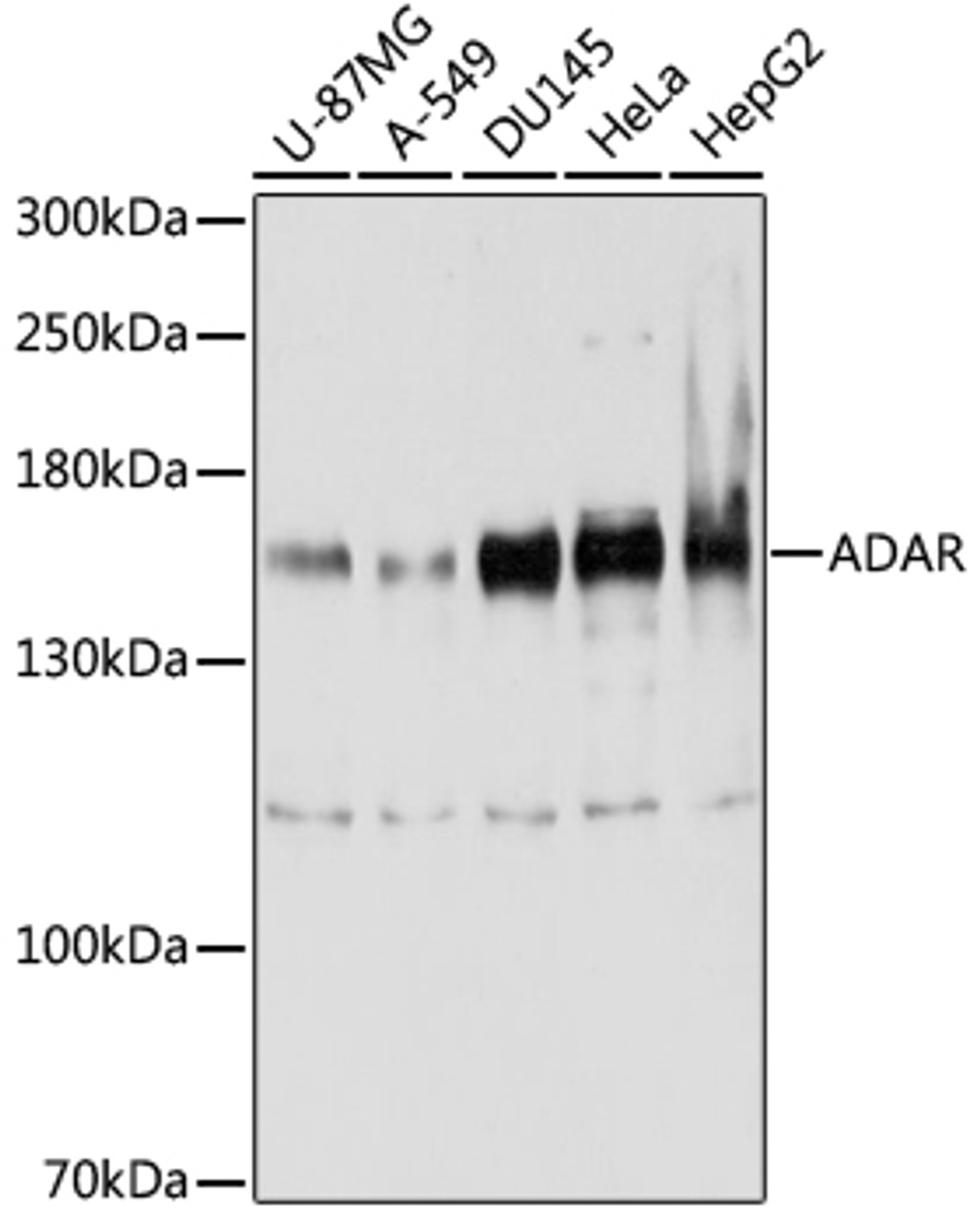 Western blot analysis of extracts of various cell lines, using ADAR antibody (23-240) at 1:1000 dilution.<br/>Secondary antibody: HRP Goat Anti-Rabbit IgG (H+L) at 1:10000 dilution.<br/>Lysates/proteins: 25ug per lane.<br/>Blocking buffer: 3% nonfat dry milk in TBST.<br/>Detection: ECL Enhanced Kit.<br/>Exposure time: 20s.