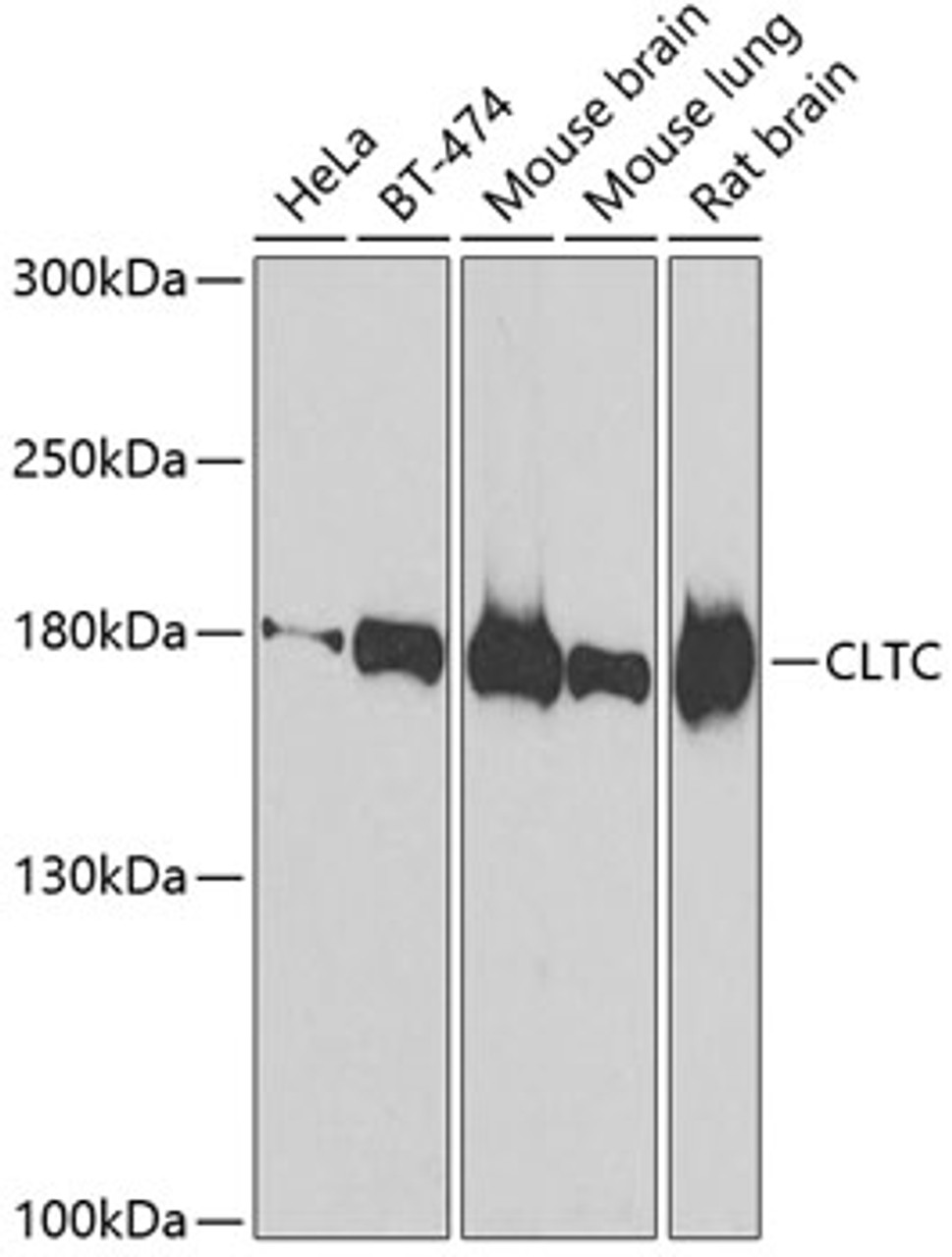 Western blot analysis of extracts of various cell lines, using CLTC antibody (23-255) at 1:500 dilution.<br/>Secondary antibody: HRP Goat Anti-Rabbit IgG (H+L) at 1:10000 dilution.<br/>Lysates/proteins: 25ug per lane.<br/>Blocking buffer: 3% nonfat dry milk in TBST.<br/>Detection: ECL Basic Kit.<br/>Exposure time: 90s.