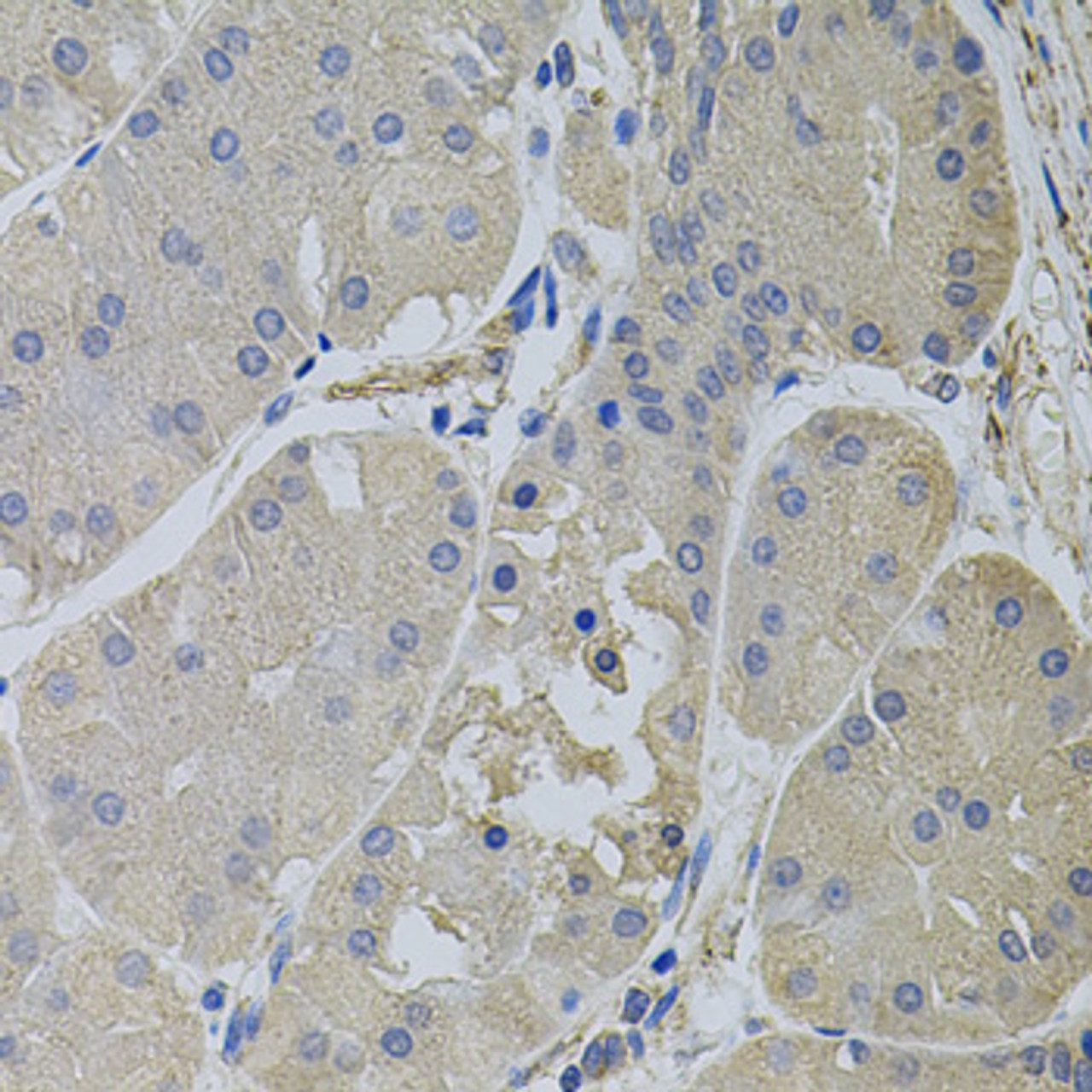 Immunohistochemistry of paraffin-embedded human stomach using CLTC antibody (23-255) (40x lens) .
