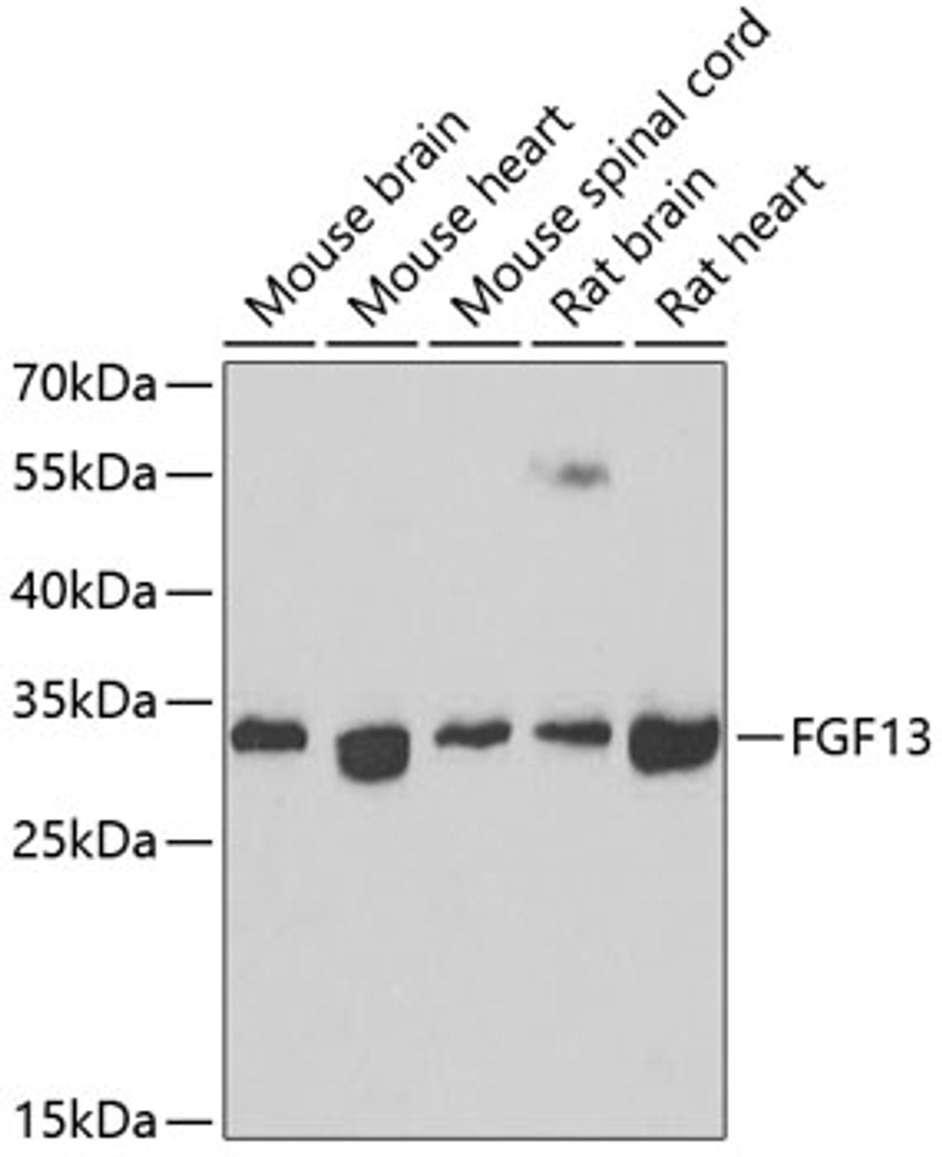 Western blot analysis of extracts of various cell lines, using FGF13 antibody (23-262) at 1:1000 dilution.<br/>Secondary antibody: HRP Goat Anti-Rabbit IgG (H+L) at 1:10000 dilution.<br/>Lysates/proteins: 25ug per lane.<br/>Blocking buffer: 3% nonfat dry milk in TBST.<br/>Detection: ECL Basic Kit.<br/>Exposure time: 90s.