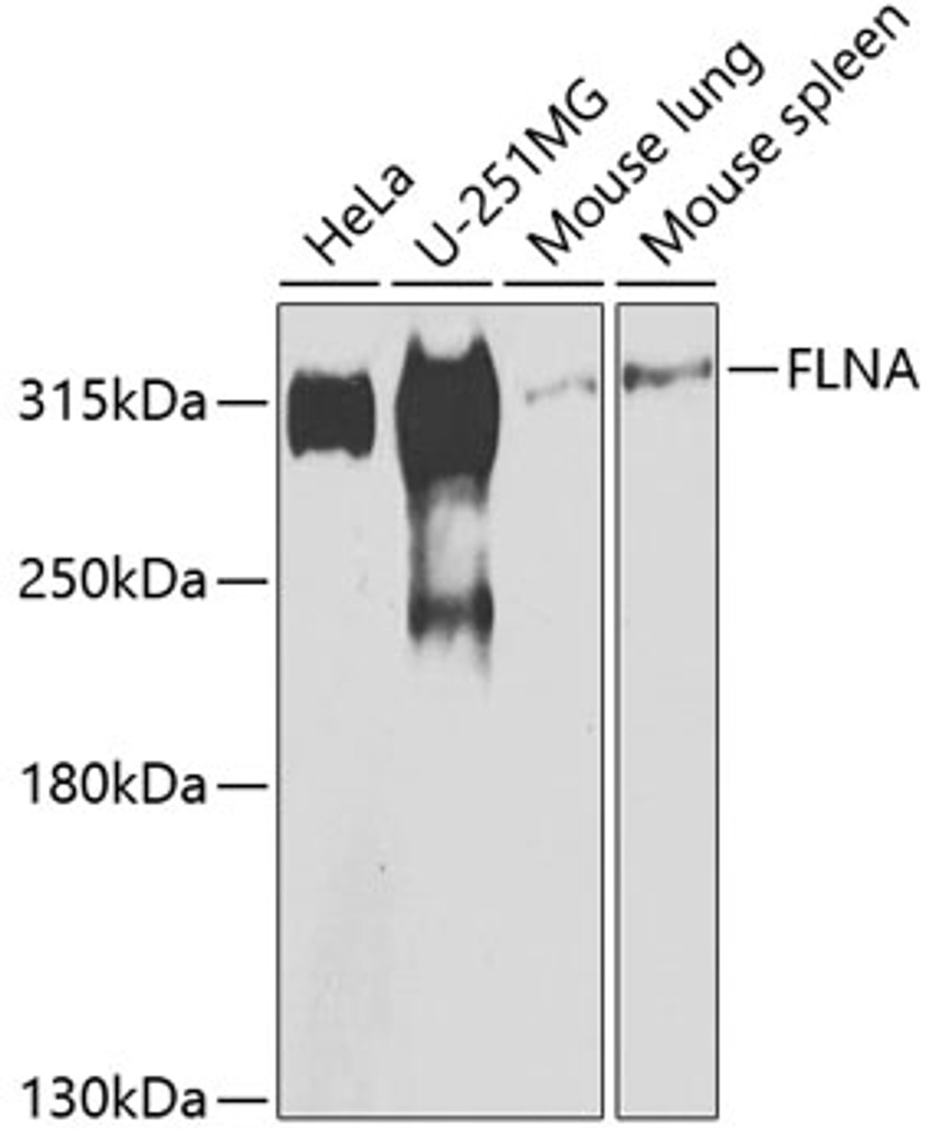 Western blot analysis of extracts of various cell lines, using FLNA antibody (23-263) at 1:500 dilution.<br/>Secondary antibody: HRP Goat Anti-Rabbit IgG (H+L) at 1:10000 dilution.<br/>Lysates/proteins: 25ug per lane.<br/>Blocking buffer: 3% nonfat dry milk in TBST.<br/>Detection: ECL Enhanced Kit.<br/>Exposure time: 30s.