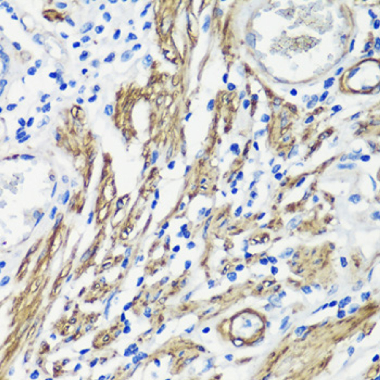Immunohistochemistry of paraffin-embedded human colon muscle using FLNA antibody (23-263) at dilution of 1:100 (40x lens) .