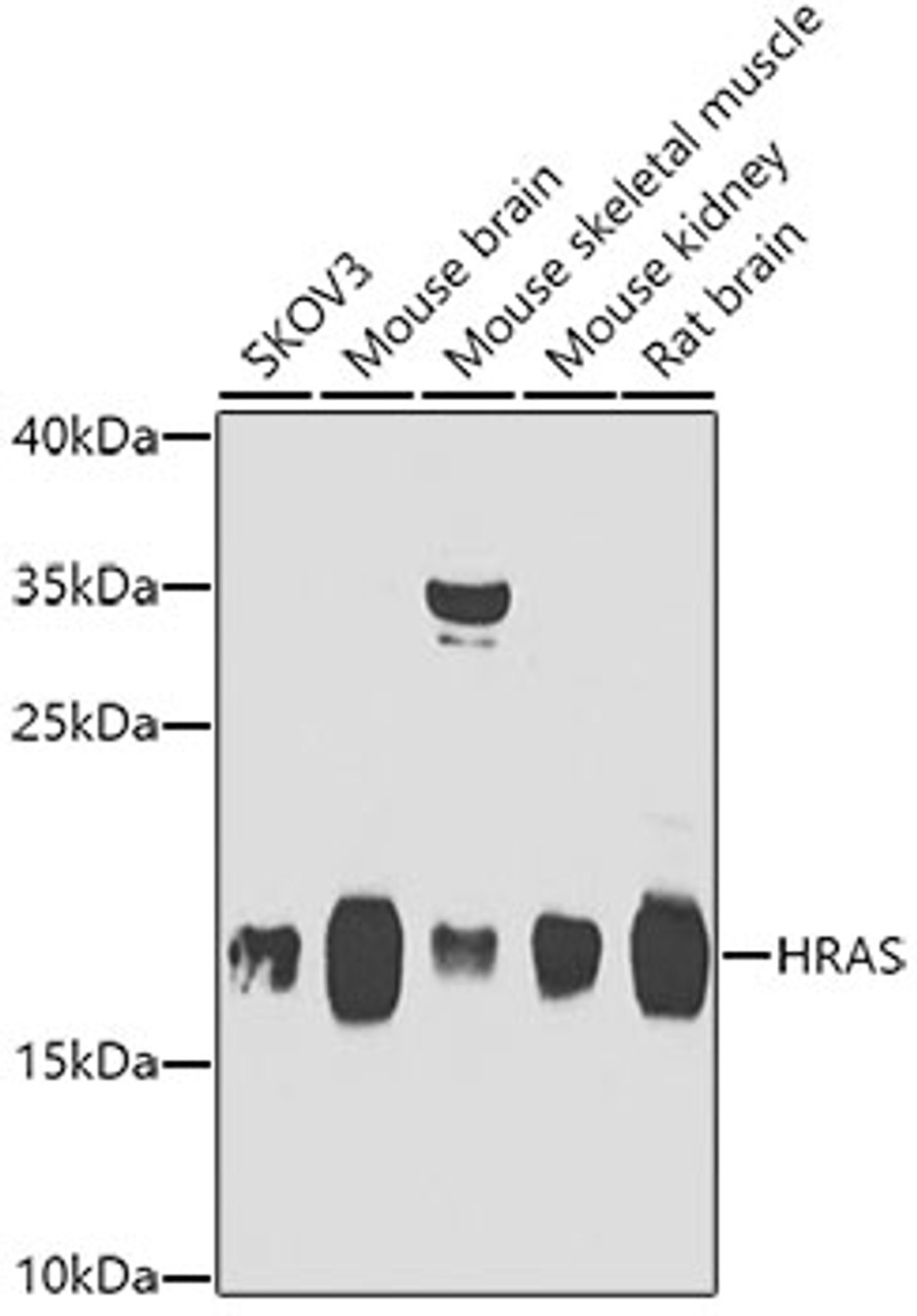 Western blot analysis of extracts of various cell lines, using HRAS antibody (23-265) at 1:1000 dilution.<br/>Secondary antibody: HRP Goat Anti-Rabbit IgG (H+L) at 1:10000 dilution.<br/>Lysates/proteins: 25ug per lane.<br/>Blocking buffer: 3% nonfat dry milk in TBST.<br/>Detection: ECL Enhanced Kit.<br/>Exposure time: 20s.