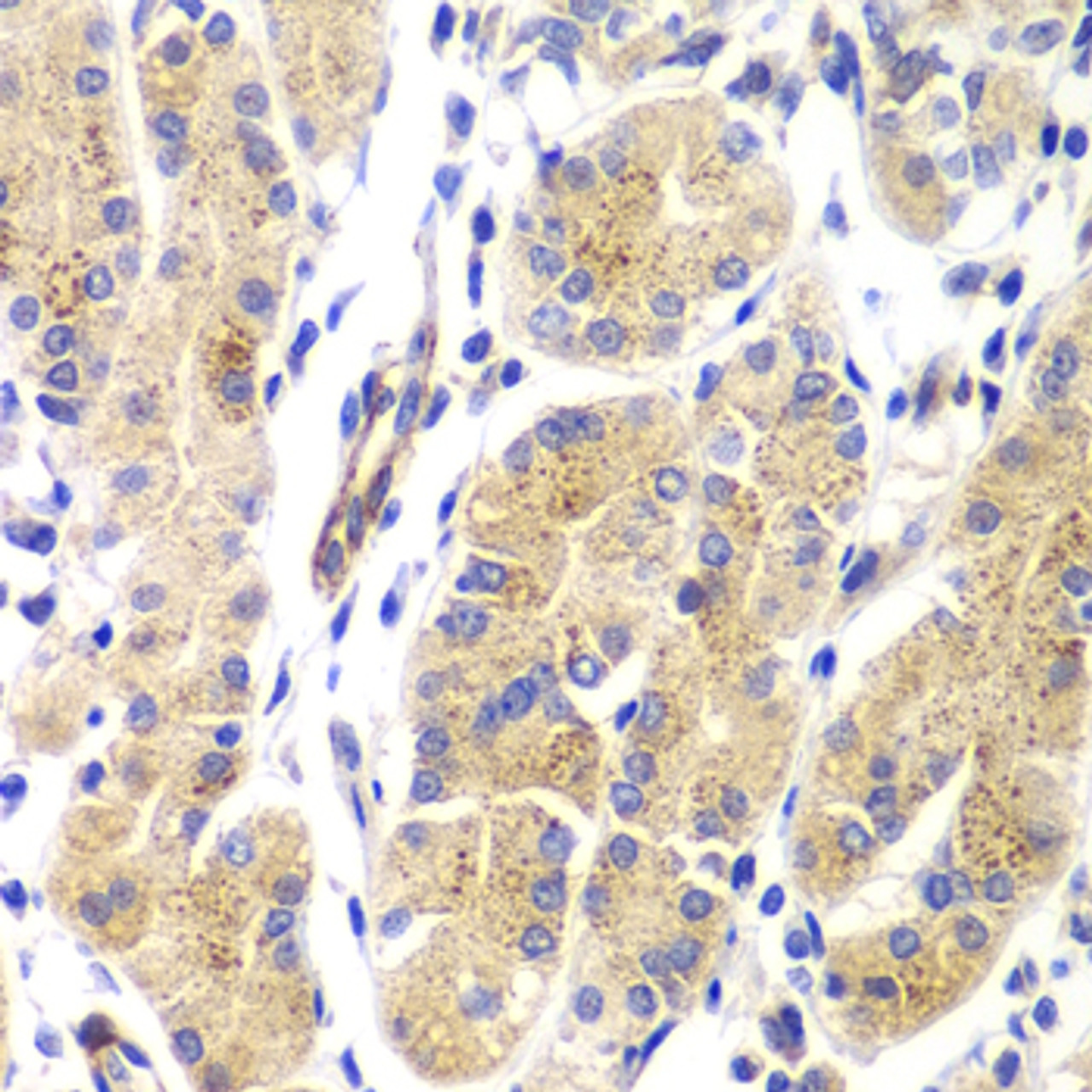 Immunohistochemistry of paraffin-embedded human gastric using HRAS antibody (23-265) at dilution of 1:100 (40x lens) .