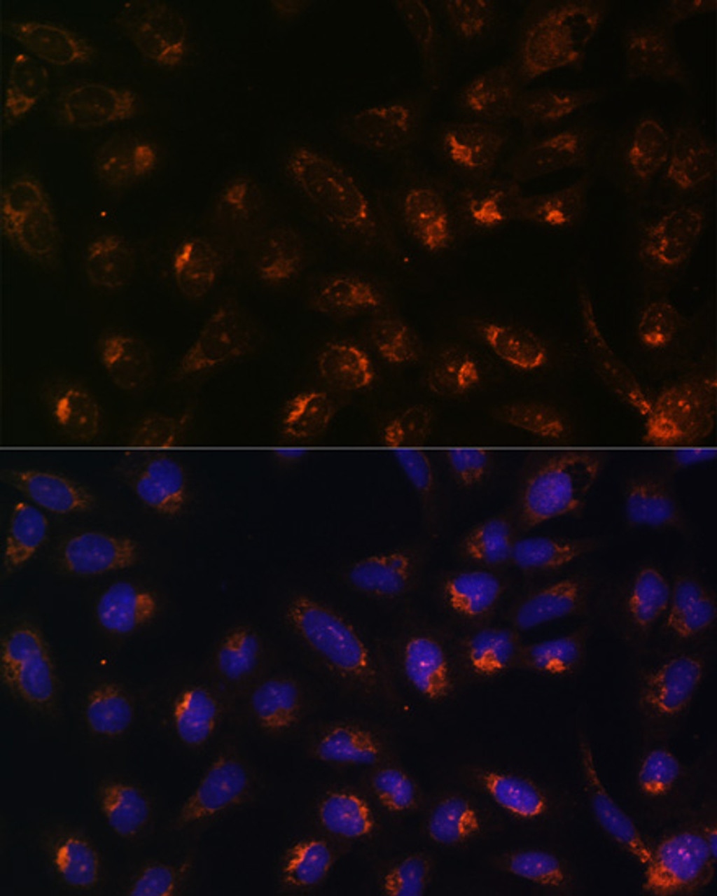 Immunofluorescence analysis of U-2 OS cells using ITPR1 antibody (23-269) at dilution of 1:100. Blue: DAPI for nuclear staining.