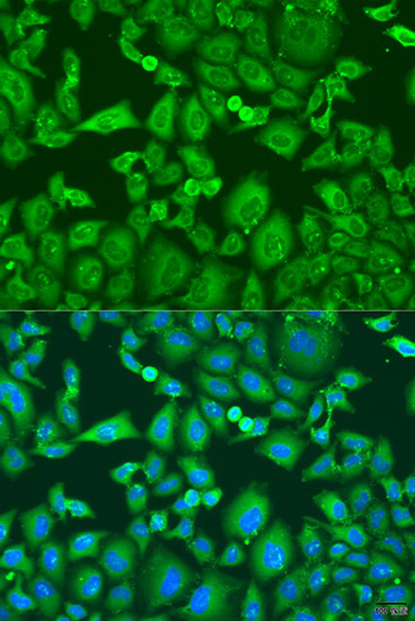 Immunofluorescence analysis of U2OS cells using KIF11 antibody (23-271) at dilution of 1:100. Blue: DAPI for nuclear staining.