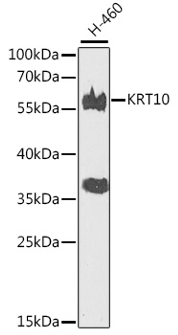 Western blot analysis of extracts of H-460 cells, using KRT10 antibody (23-272) at 1:500 dilution.<br/>Secondary antibody: HRP Goat Anti-Rabbit IgG (H+L) at 1:10000 dilution.<br/>Lysates/proteins: 25ug per lane.<br/>Blocking buffer: 3% nonfat dry milk in TBST.<br/>Detection: ECL Basic Kit.<br/>Exposure time: 90s.