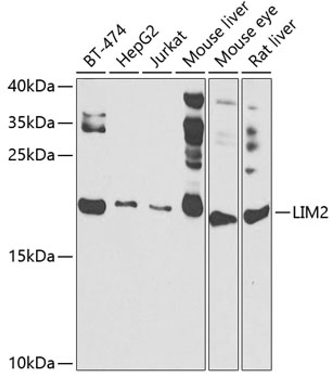 Western blot analysis of extracts of various cell lines, using LIM2 antibody (23-273) at 1:1000 dilution.<br/>Secondary antibody: HRP Goat Anti-Rabbit IgG (H+L) at 1:10000 dilution.<br/>Lysates/proteins: 25ug per lane.<br/>Blocking buffer: 3% nonfat dry milk in TBST.<br/>Detection: ECL Basic Kit.<br/>Exposure time: 90s.