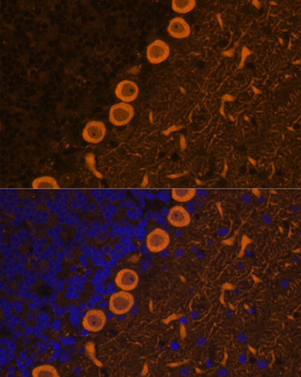 Immunofluorescence analysis of rat brain cells using PRKCG antibody (23-281) at dilution of 1:100. Blue: DAPI for nuclear staining.