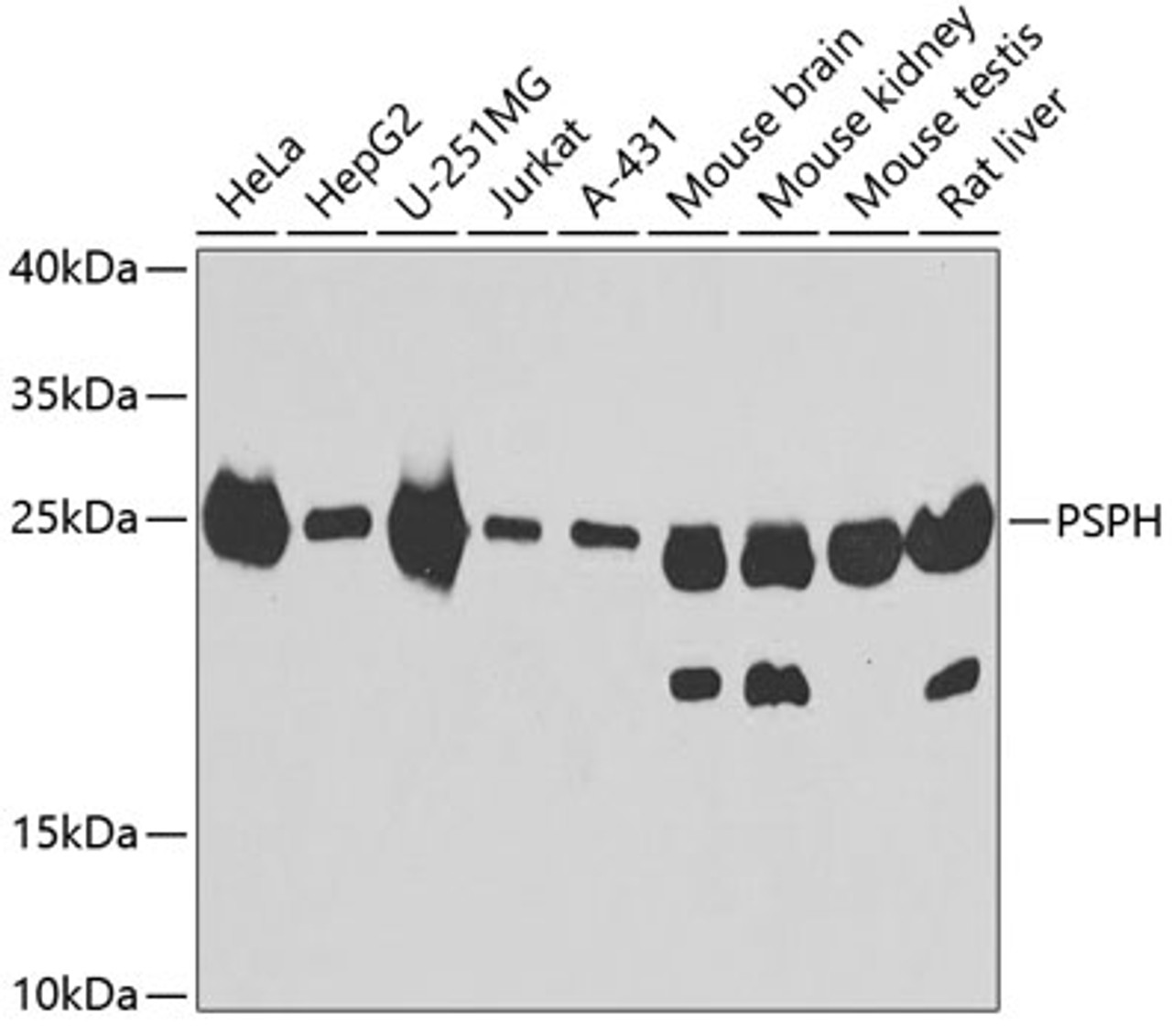 Western blot analysis of extracts of various cell lines, using PSPH antibody (23-282) at 1:1000 dilution.<br/>Secondary antibody: HRP Goat Anti-Rabbit IgG (H+L) at 1:10000 dilution.<br/>Lysates/proteins: 25ug per lane.<br/>Blocking buffer: 3% nonfat dry milk in TBST.<br/>Detection: ECL Basic Kit.<br/>Exposure time: 90s.