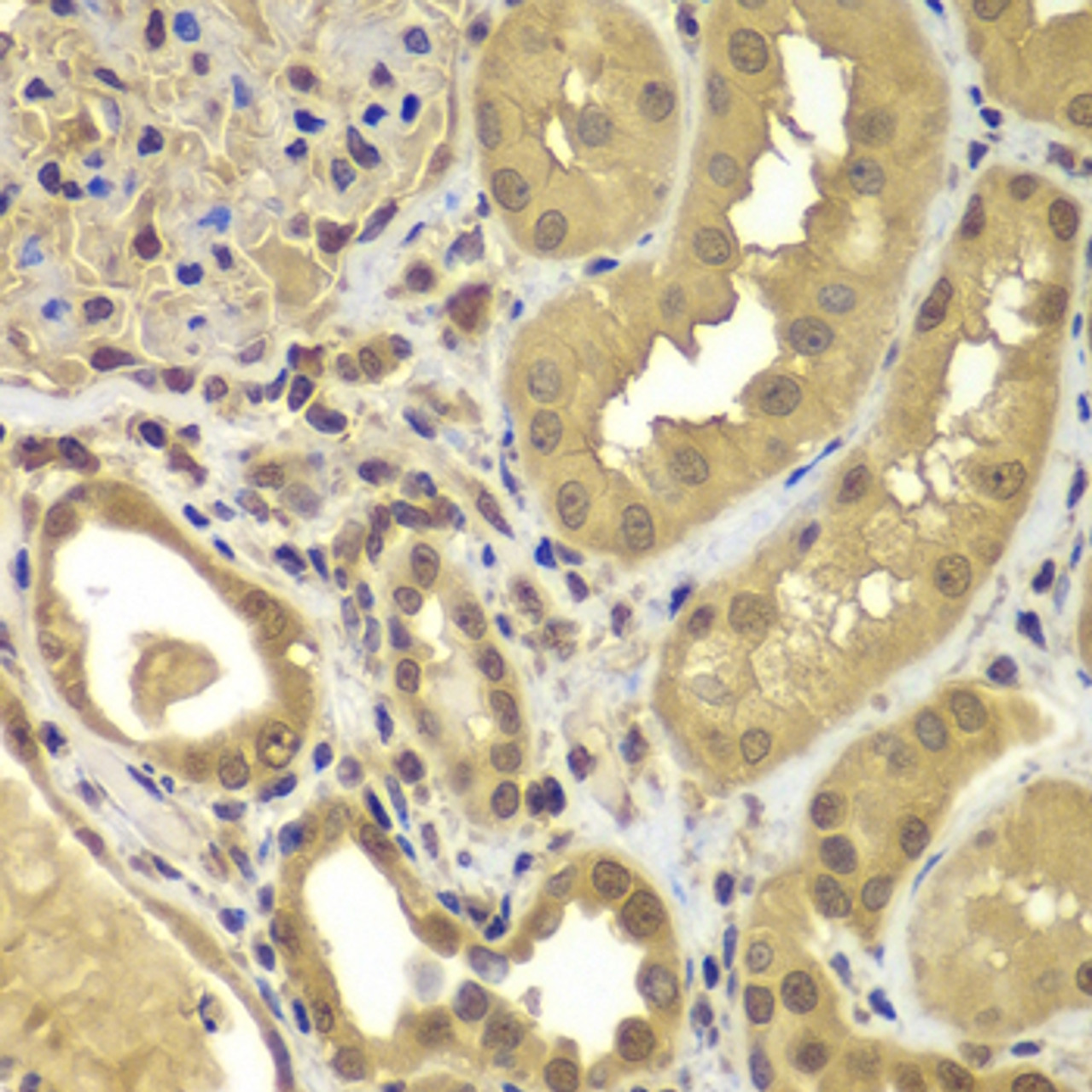 Immunohistochemistry of paraffin-embedded human kidney using SORT1 antibody (23-283) at dilution of 1:100 (40x lens) .