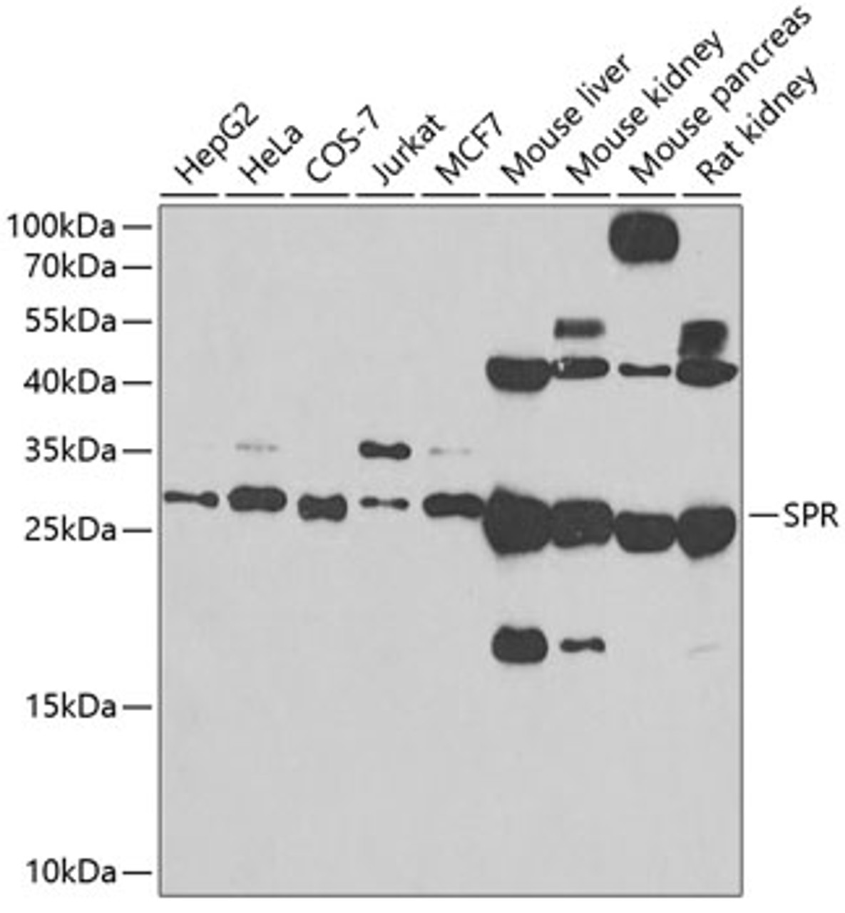 Western blot analysis of extracts of various cell lines, using SPR antibody (23-285) at 1:500 dilution.<br/>Secondary antibody: HRP Goat Anti-Rabbit IgG (H+L) at 1:10000 dilution.<br/>Lysates/proteins: 25ug per lane.<br/>Blocking buffer: 3% nonfat dry milk in TBST.<br/>Detection: ECL Basic Kit.<br/>Exposure time: 90s.
