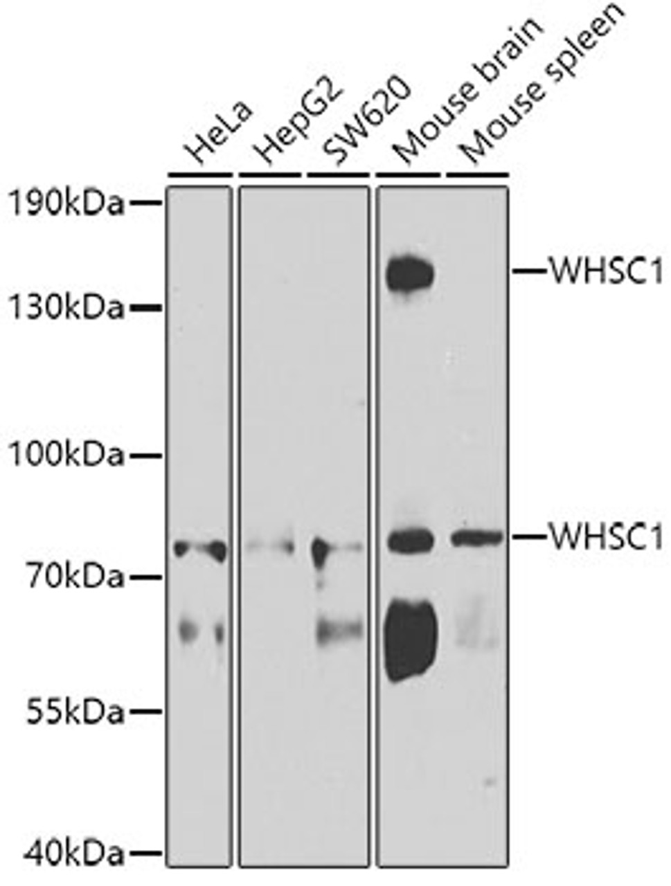 Western blot analysis of extracts of various cell lines, using WHSC1 antibody (23-292) at 1:1000 dilution.<br/>Secondary antibody: HRP Goat Anti-Rabbit IgG (H+L) at 1:10000 dilution.<br/>Lysates/proteins: 25ug per lane.<br/>Blocking buffer: 3% nonfat dry milk in TBST.<br/>Detection: ECL Basic Kit.<br/>Exposure time: 90s.