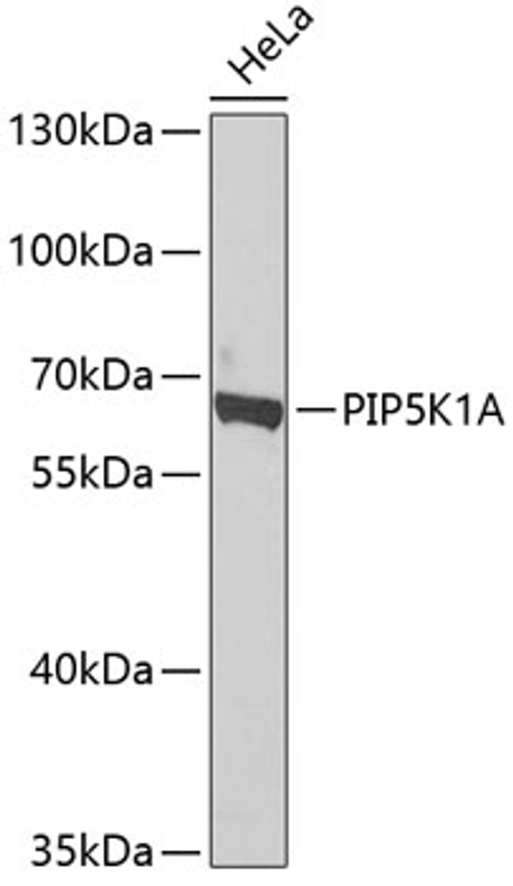 Western blot analysis of extracts of HeLa cells, using PIP5K1A antibody (23-295) at 1:1000 dilution.<br/>Secondary antibody: HRP Goat Anti-Rabbit IgG (H+L) at 1:10000 dilution.<br/>Lysates/proteins: 25ug per lane.<br/>Blocking buffer: 3% nonfat dry milk in TBST.<br/>Detection: ECL Basic Kit.<br/>Exposure time: 90s.