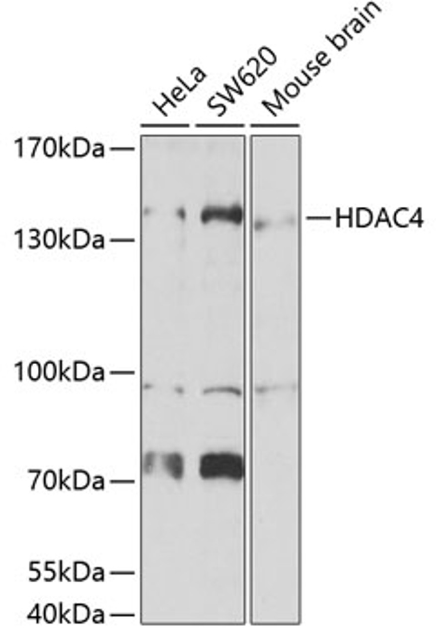 Western blot analysis of extracts of various cell lines, using HDAC4 antibody (23-304) at 1:1000 dilution._Secondary antibody: HRP Goat Anti-Rabbit IgG (H+L) at 1:10000 dilution._Lysates/proteins: 25ug per lane._Blocking buffer: 3% nonfat dry milk in TBST._Detection: ECL Enhanced Kit._Exposure time: 90s.