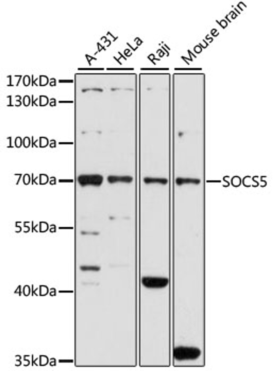 Western blot analysis of extracts of various cell lines, using SOCS5 antibody (23-305) at 1:1000 dilution.<br/>Secondary antibody: HRP Goat Anti-Rabbit IgG (H+L) at 1:10000 dilution.<br/>Lysates/proteins: 25ug per lane.<br/>Blocking buffer: 3% nonfat dry milk in TBST.<br/>Detection: ECL Basic Kit.<br/>Exposure time: 60s.