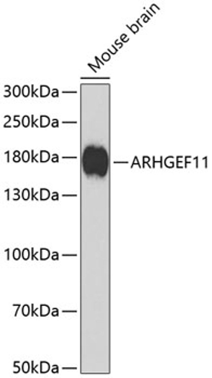 Western blot analysis of extracts of mouse brain, using ARHGEF11 antibody (23-307) at 1:1000 dilution.<br/>Secondary antibody: HRP Goat Anti-Rabbit IgG (H+L) at 1:10000 dilution.<br/>Lysates/proteins: 25ug per lane.<br/>Blocking buffer: 3% nonfat dry milk in TBST.<br/>Detection: ECL Basic Kit.<br/>Exposure time: 90s.