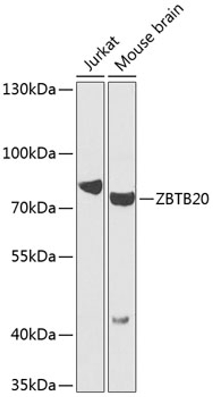 Western blot analysis of extracts of various cell lines, using ZBTB20 antibody (23-318) at 1:1000 dilution.<br/>Secondary antibody: HRP Goat Anti-Rabbit IgG (H+L) at 1:10000 dilution.<br/>Lysates/proteins: 25ug per lane.<br/>Blocking buffer: 3% nonfat dry milk in TBST.<br/>Detection: ECL Basic Kit.<br/>Exposure time: 90s.