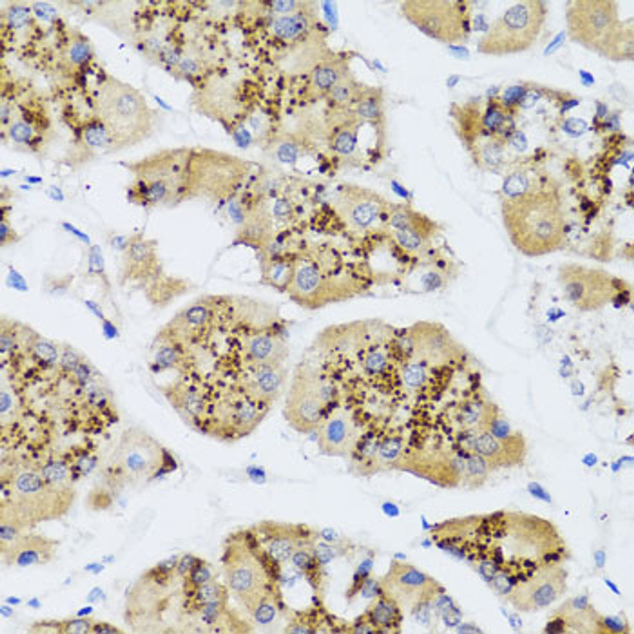 Immunohistochemistry of paraffin-embedded human stomach using CHIC2 antibody (23-319) at dilution of 1:100 (40x lens) .