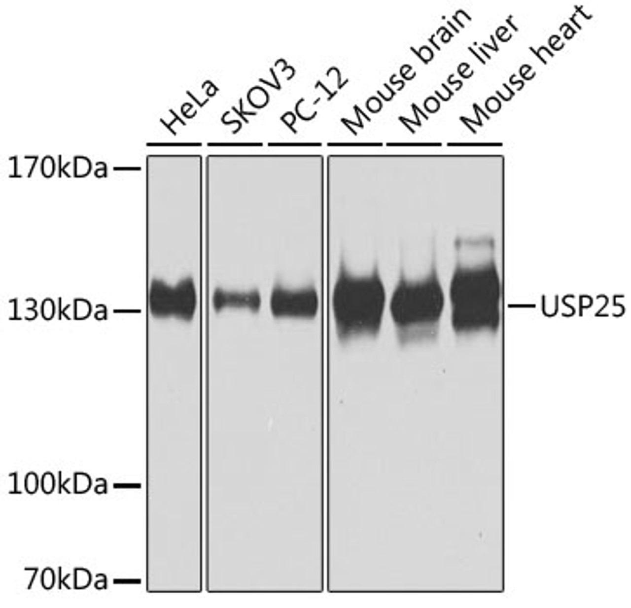 Western blot analysis of extracts of various cell lines, using USP25 antibody (23-321) at 1:1000 dilution.<br/>Secondary antibody: HRP Goat Anti-Rabbit IgG (H+L) at 1:10000 dilution.<br/>Lysates/proteins: 25ug per lane.<br/>Blocking buffer: 3% nonfat dry milk in TBST.<br/>Detection: ECL Basic Kit.<br/>Exposure time: 60s.