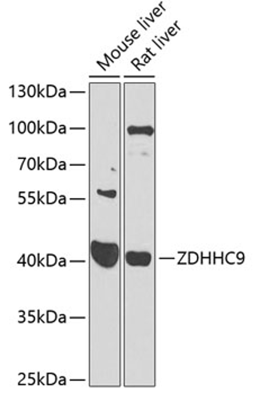 Western blot analysis of extracts of various cell lines, using ZDHHC9 antibody (23-323) at 1:1000 dilution._Secondary antibody: HRP Goat Anti-Rabbit IgG (H+L) at 1:10000 dilution._Lysates/proteins: 25ug per lane._Blocking buffer: 3% nonfat dry milk in TBST._Detection: ECL Enhanced Kit._Exposure time: 90s.