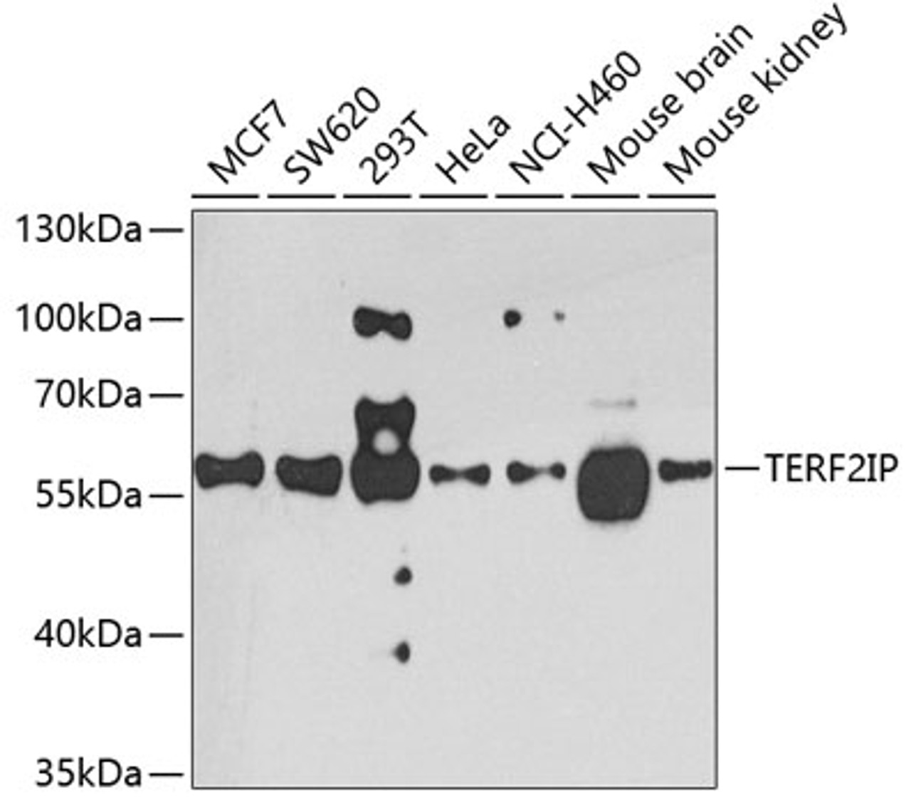 Western blot analysis of extracts of various cell lines, using TERF2IP antibody (23-327) at 1:1000 dilution.<br/>Secondary antibody: HRP Goat Anti-Rabbit IgG (H+L) at 1:10000 dilution.<br/>Lysates/proteins: 25ug per lane.<br/>Blocking buffer: 3% nonfat dry milk in TBST.<br/>Detection: ECL Basic Kit.<br/>Exposure time: 90s.