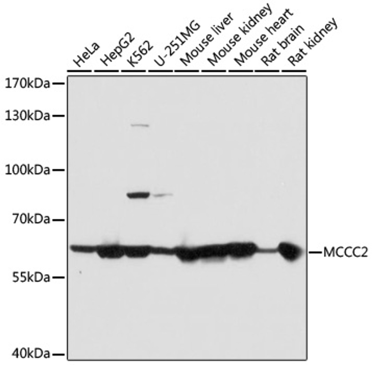 Immunohistochemistry of paraffin-embedded human prostate using MCCC2 antibody (23-334) at dilution of 1:100 (40x lens) .