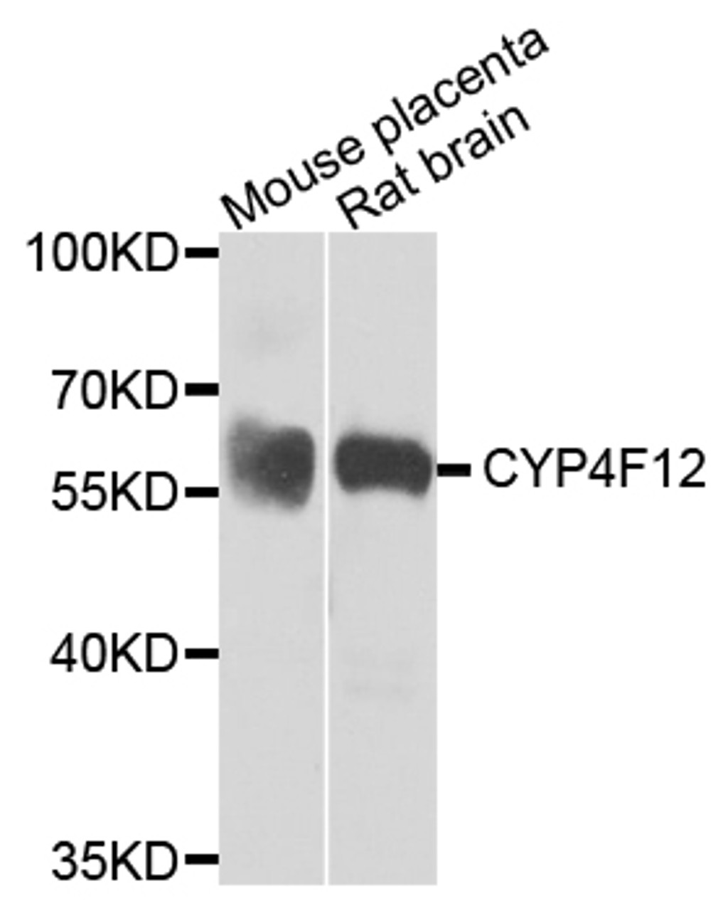 Western blot analysis of extracts of various cell lines, using CYP4F12 antibody (23-336) at 1:1000 dilution.<br/>Secondary antibody: HRP Goat Anti-Rabbit IgG (H+L) at 1:10000 dilution.<br/>Lysates/proteins: 25ug per lane.<br/>Blocking buffer: 3% nonfat dry milk in TBST.<br/>Detection: ECL Basic Kit.<br/>Exposure time: 30s.