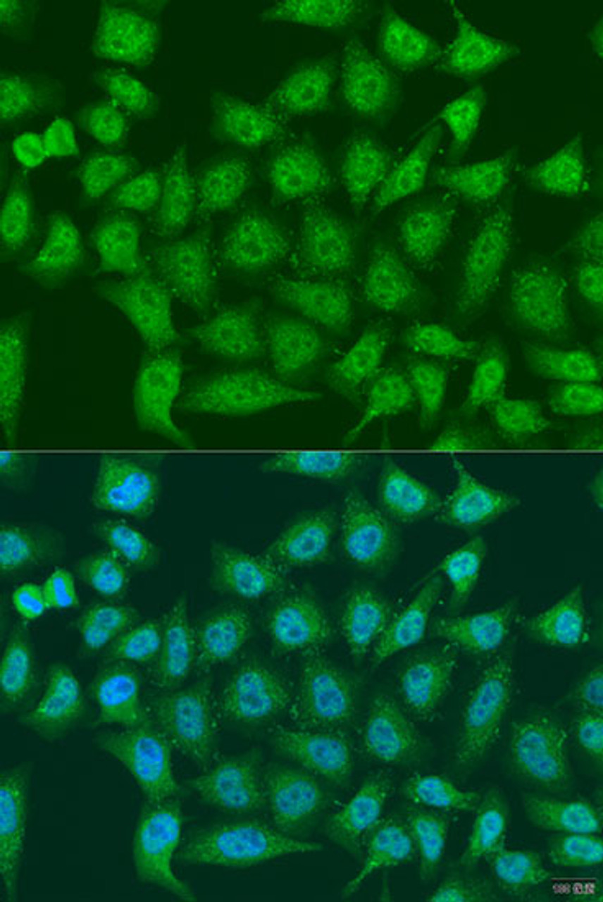Immunofluorescence analysis of U2OS cells using EGLN3 antibody (23-341) at dilution of 1:100. Blue: DAPI for nuclear staining.