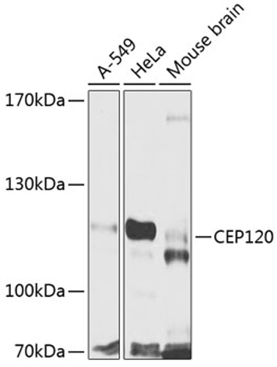 Western blot analysis of extracts of various cell lines, using CEP120 antibody (23-344) at 1:1000 dilution.<br/>Secondary antibody: HRP Goat Anti-Rabbit IgG (H+L) at 1:10000 dilution.<br/>Lysates/proteins: 25ug per lane.<br/>Blocking buffer: 3% nonfat dry milk in TBST.<br/>Detection: ECL Basic Kit.<br/>Exposure time: 90s.