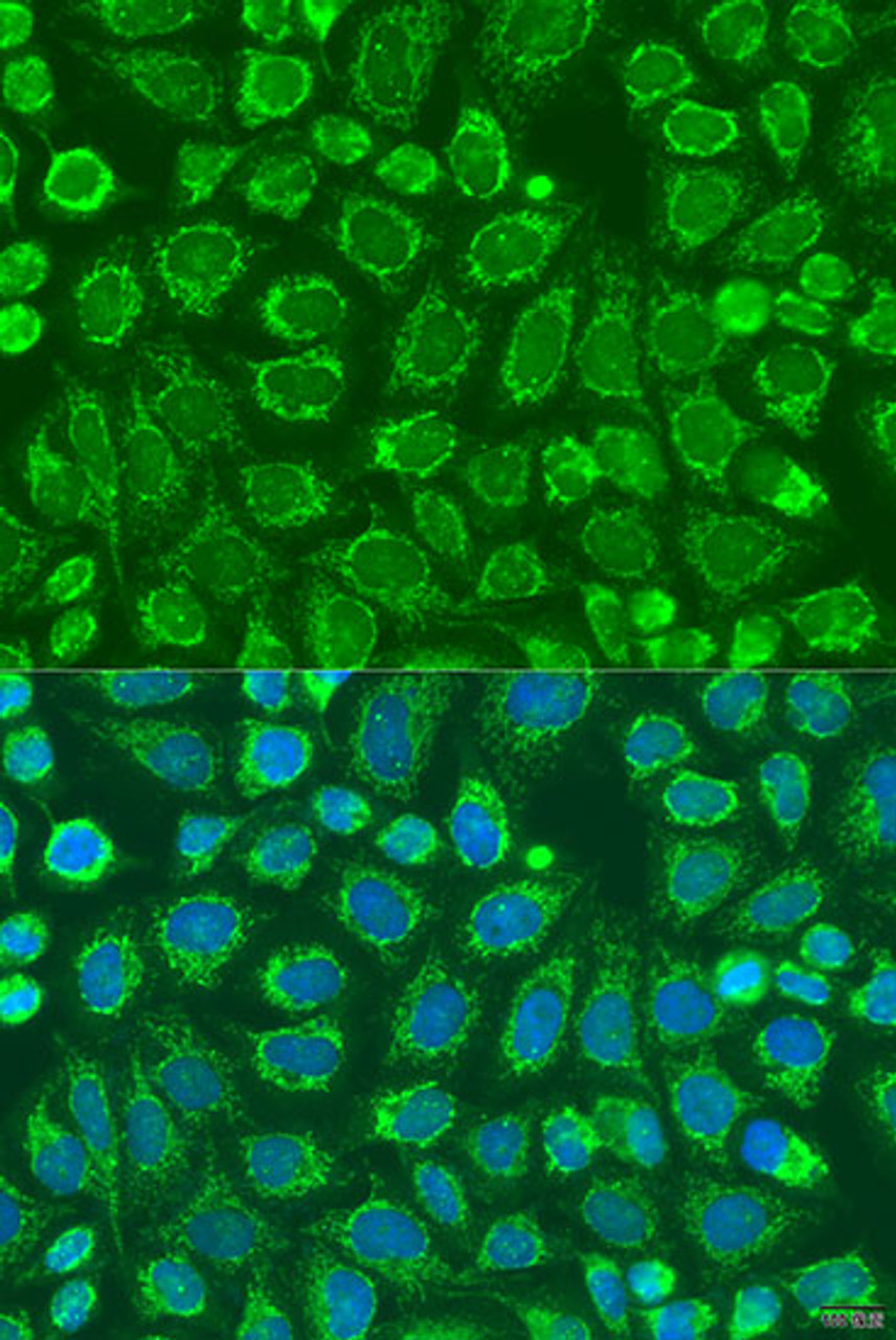 Immunofluorescence analysis of U2OS cells using SNX32 antibody (23-346) at dilution of 1:100. Blue: DAPI for nuclear staining.