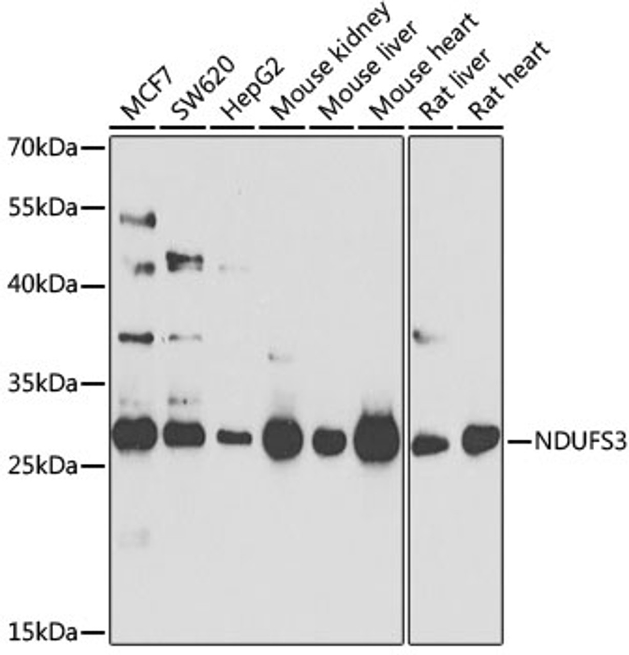 Western blot analysis of extracts of various cell lines, using NDUFS3 antibody (23-351) at 1:1000 dilution.<br/>Secondary antibody: HRP Goat Anti-Rabbit IgG (H+L) at 1:10000 dilution.<br/>Lysates/proteins: 25ug per lane.<br/>Blocking buffer: 3% nonfat dry milk in TBST.<br/>Detection: ECL Basic Kit.<br/>Exposure time: 90s.