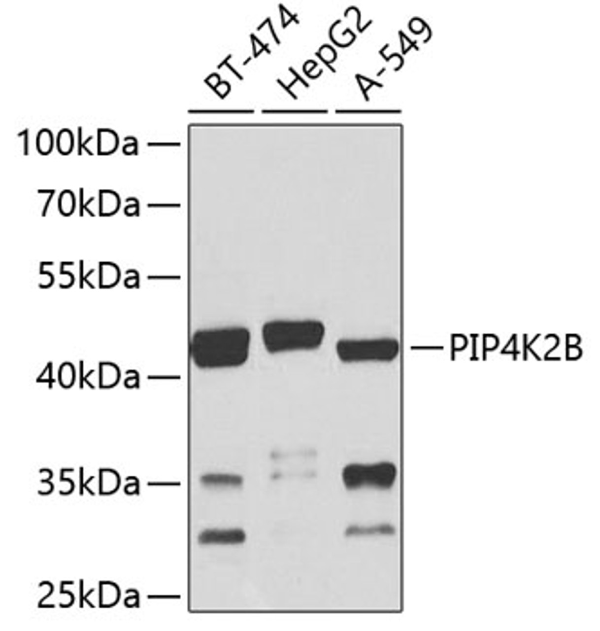 Western blot analysis of extracts of various cell lines, using PIP4K2B antibody (23-354) at 1:1000 dilution.<br/>Secondary antibody: HRP Goat Anti-Rabbit IgG (H+L) at 1:10000 dilution.<br/>Lysates/proteins: 25ug per lane.<br/>Blocking buffer: 3% nonfat dry milk in TBST.<br/>Detection: ECL Basic Kit.<br/>Exposure time: 30s.