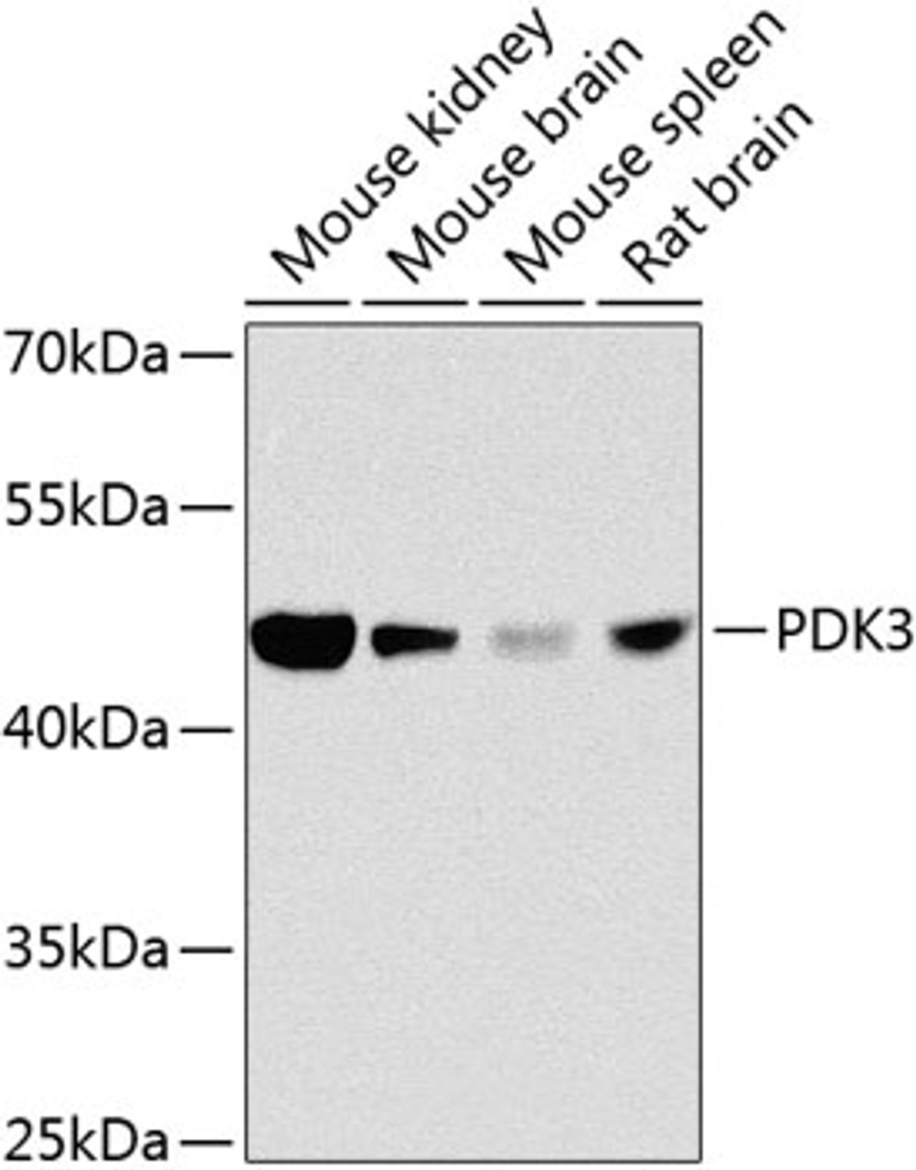 Western blot analysis of extracts of various cell lines, using PDK3 antibody (23-359) at 1:1000 dilution.<br/>Secondary antibody: HRP Goat Anti-Rabbit IgG (H+L) at 1:10000 dilution.<br/>Lysates/proteins: 25ug per lane.<br/>Blocking buffer: 3% nonfat dry milk in TBST.<br/>Detection: ECL Basic Kit.<br/>Exposure time: 1s.