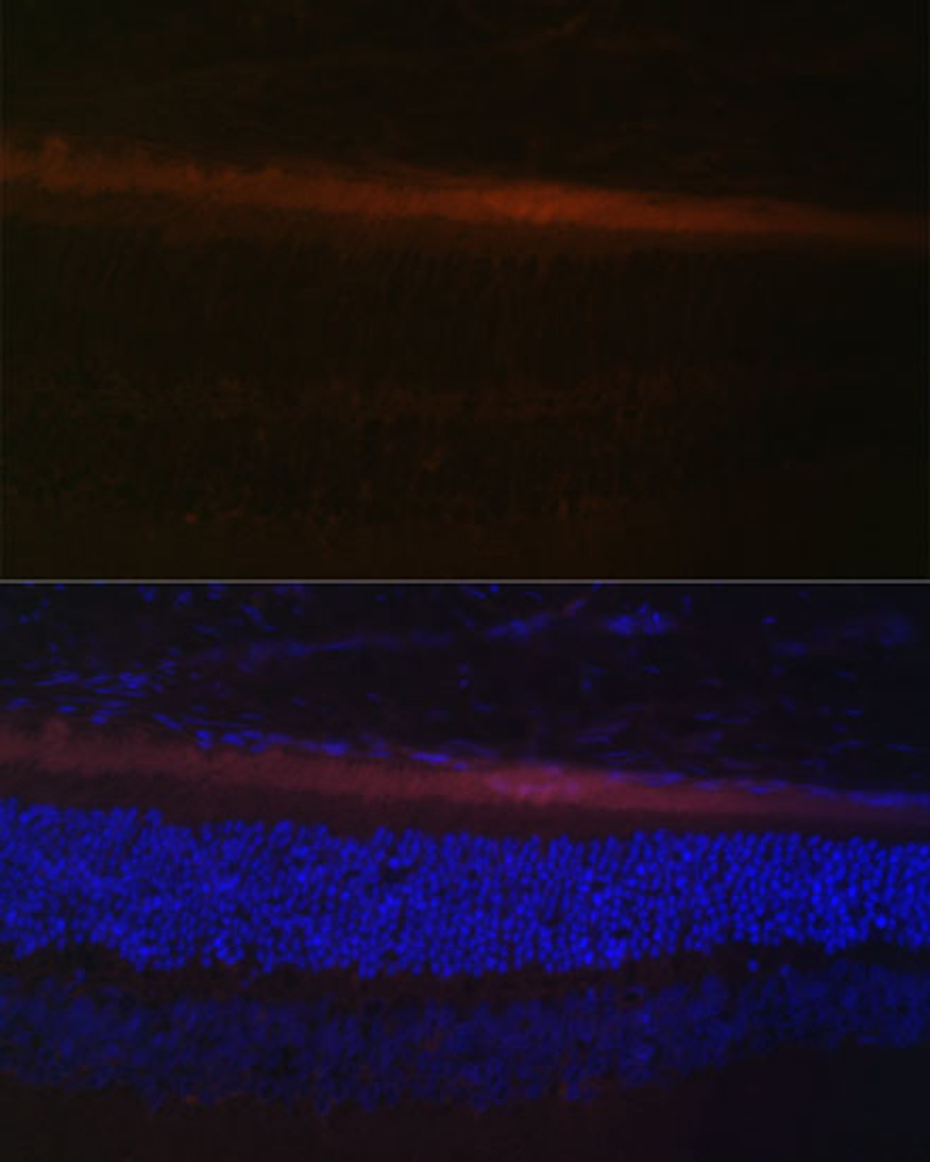 Immunofluorescence analysis of rat retina using RDH5 Polyclonal Antibody (23-369) at dilution of 1:100 (40x lens) . Blue: DAPI for nuclear staining.