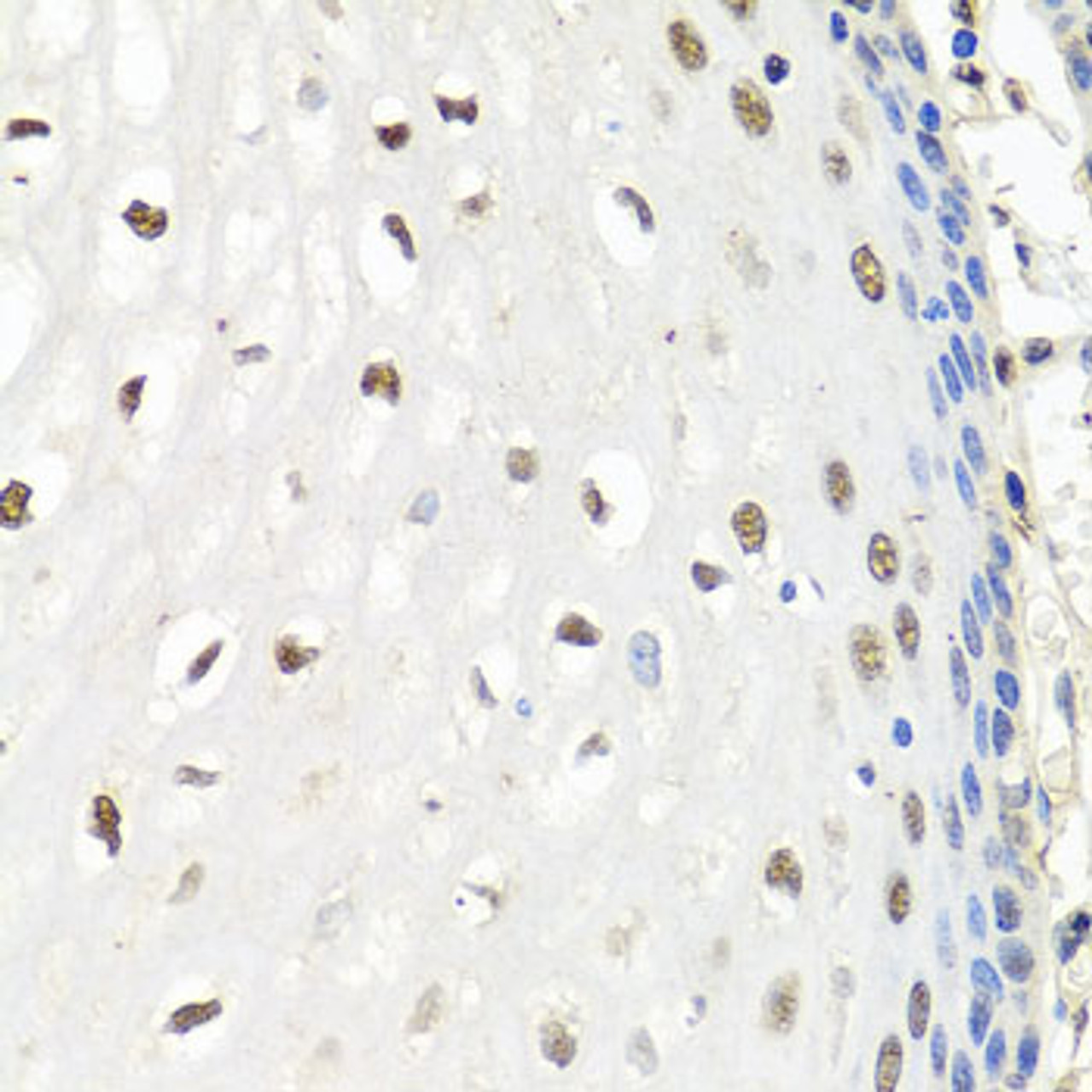 Immunohistochemistry of paraffin-embedded human esophagus using CNOT8 antibody (23-371) at dilution of 1:100 (40x lens) .