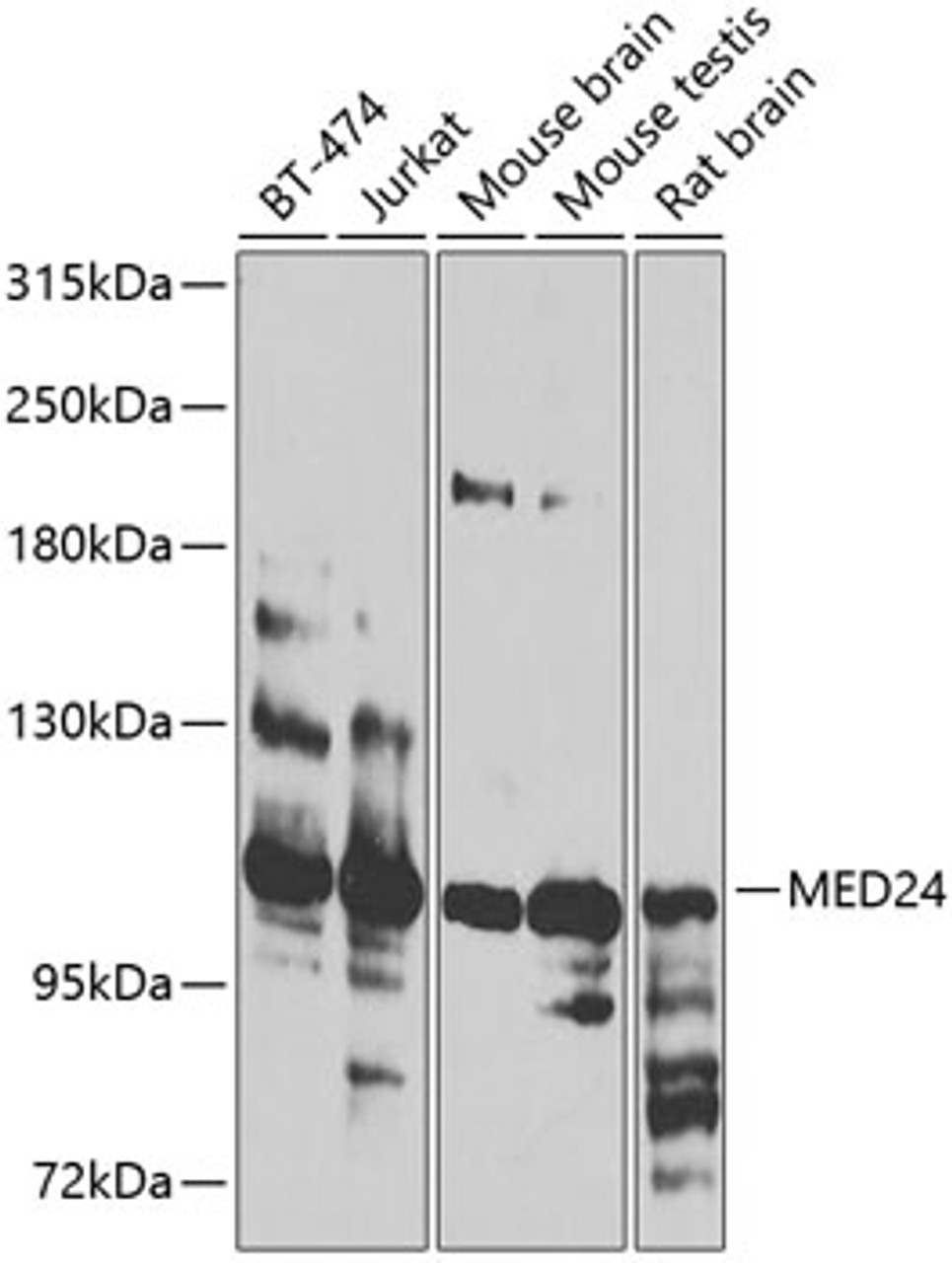 Western blot analysis of extracts of various cell lines, using MED24 antibody (23-372) at 1:1000 dilution.<br/>Secondary antibody: HRP Goat Anti-Rabbit IgG (H+L) at 1:10000 dilution.<br/>Lysates/proteins: 25ug per lane.<br/>Blocking buffer: 3% nonfat dry milk in TBST.<br/>Detection: ECL Basic Kit.<br/>Exposure time: 45s.