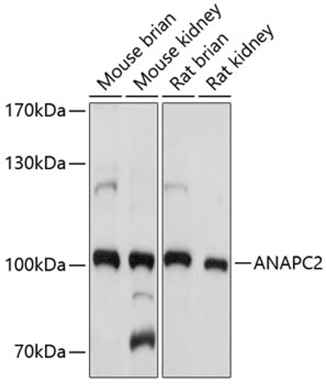 Western blot analysis of extracts of various cell lines, using ANAPC2 antibody (23-377) at 1:1000 dilution.<br/>Secondary antibody: HRP Goat Anti-Rabbit IgG (H+L) at 1:10000 dilution.<br/>Lysates/proteins: 25ug per lane.<br/>Blocking buffer: 3% nonfat dry milk in TBST.<br/>Detection: ECL Basic Kit.<br/>Exposure time: 5s.